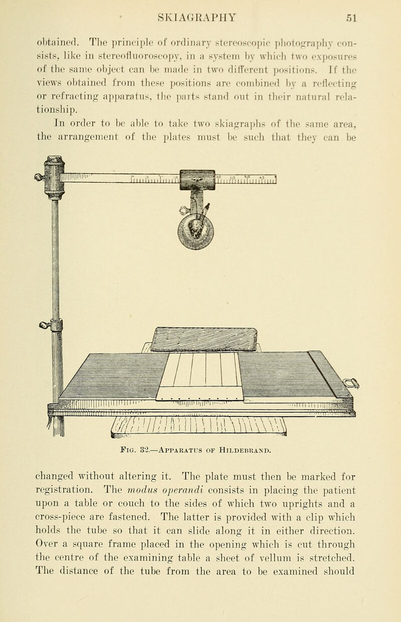 obtained. The principle of ordinary stereoscopic photography ••(in- sists, like in stereofluoroscopy, in a system by which two exposures of the same objed can be made iii two different positions, [f the views obtained from these positions are combined by a reflecting or refracting apparatus, the parts stand out in their natural rela- tionship. In order to he able to take two skiagraphs of the same area, the arrangement of the plates must he such that they ean be TmifiiiiTiiri'iinl Wi!/i;im\\\\\\\wm Fig. 32.—Apparatus of Hildebrand. changed without altering it. The plate must then be marked for registration. The modus operandi consists in placing the patient upon a table or couch to the sides of which two uprights and a cross-piece are fastened. The latter is provided with a clip which holds the tube so that it can slide along it in either direction. Over a scmare frame placed in the opening which is cut through the centre of the examining table a sheet of vellum is stretched. The distance of the tube from the area to be examined should