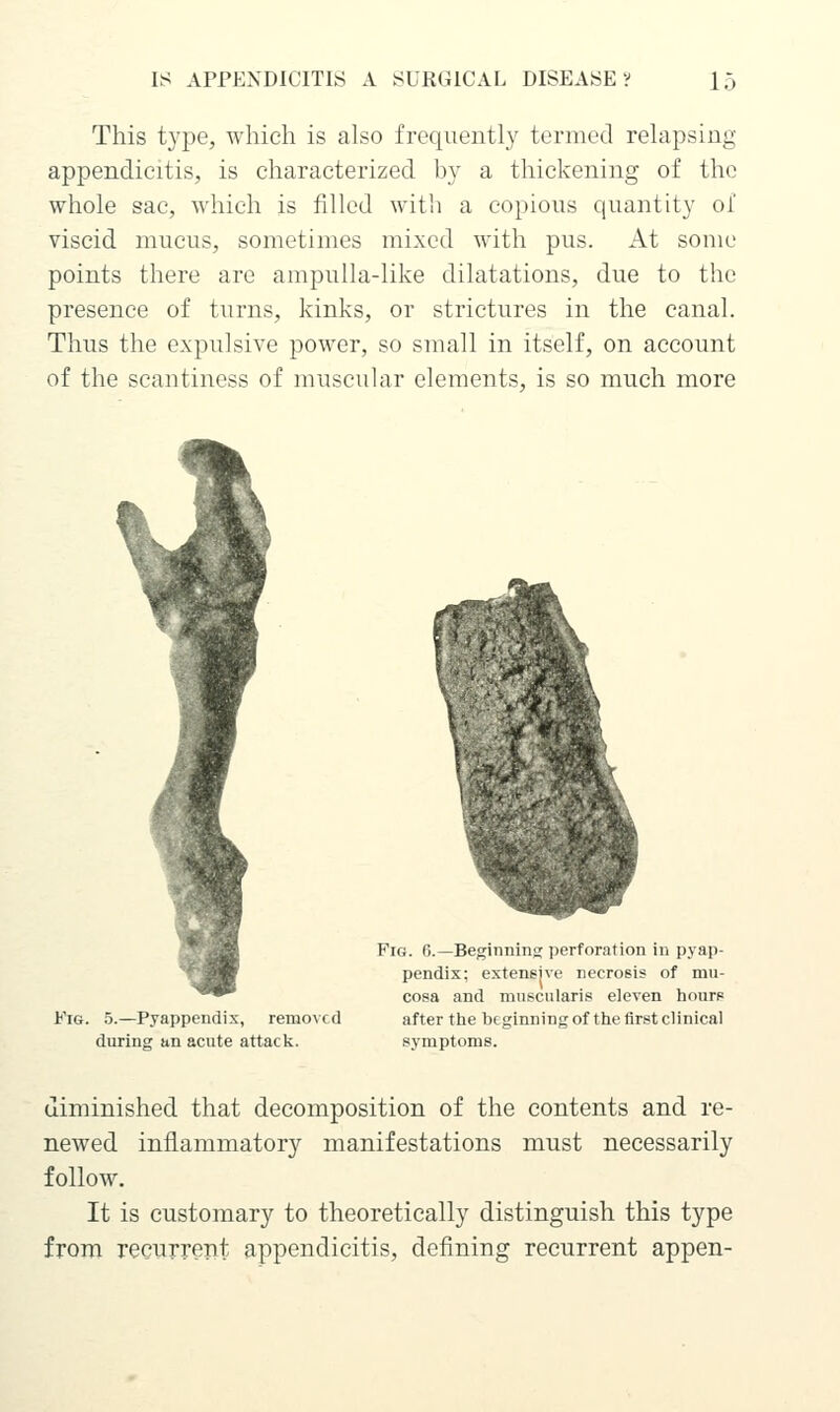 This type, which is also frequently termed relapsing appendicitis, is characterized by a thickening of the whole sac, which is filled with a copious quantity of viscid mucus, sometimes mixed with pus. At some points there arc ampulla-like dilatations, due to the presence of turns, kinks, or strictures in the canal. Thus the expulsive power, so small in itself, on account of the scantiness of muscular elements, is so much more Fig. 5.—Pyappendix, remo\cd during an acute attack. Fig. 6.—Beginning perforation in pyap- pendix; extensive necrosis of mu- cosa and muscularis eleven hours after tlie beginning of the first clinical symptoms. diminished that decomposition of the contents and re- newed inflammatory manifestations must necessarily follow. It is customary to theoretically distinguish this type from recurrent appendicitis, defining recurrent appen-