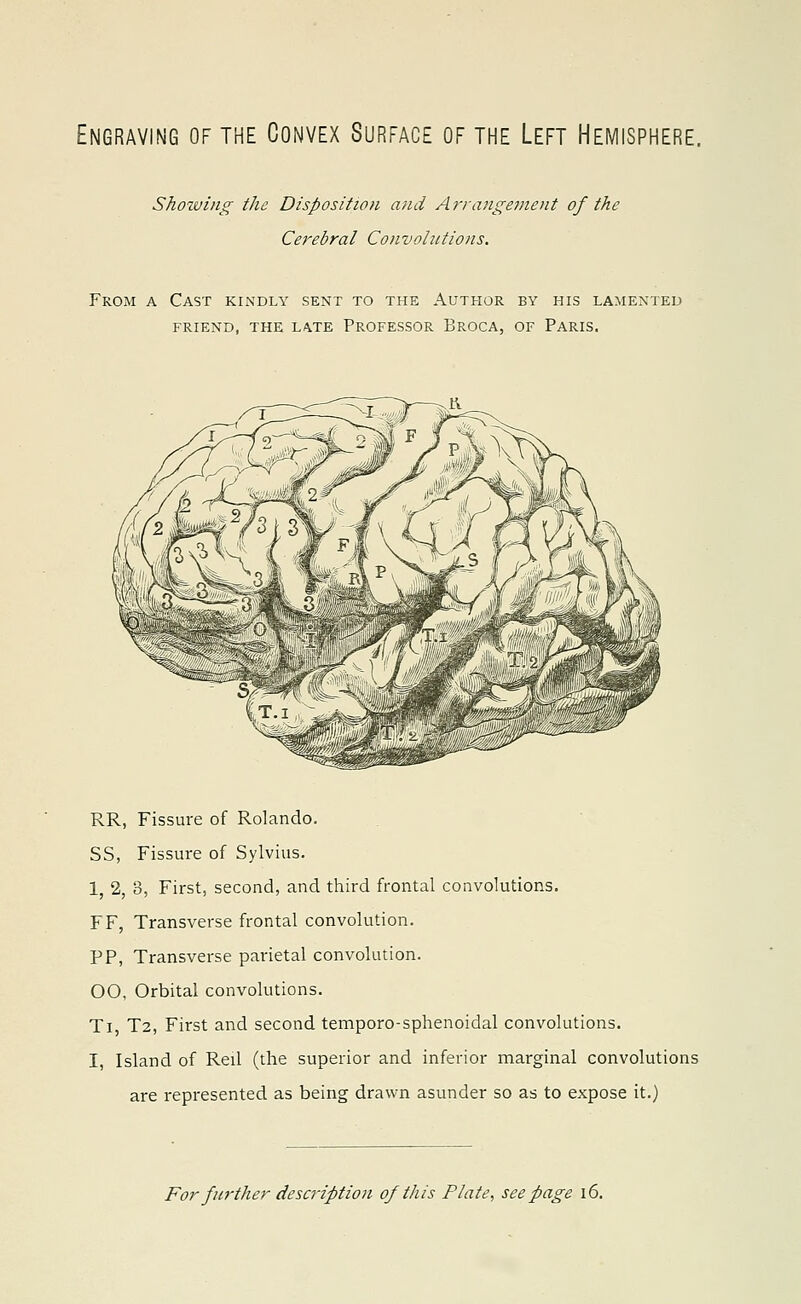 Engraving of the Convex Surface of the Left Hemisphere. Shoxving the Disposition and Arrangement of the Cerebral Convolutions. From a Cast kindly sent to the Author by his lamented friend, the late professor broca, of paris. RR, Fissure of Rolando. SS, Fissure of Sylvius. 1 2, 3, First, second, and third frontal convolutions. FF, Transverse frontal convolution. PP, Transverse parietal convolution. 00, Orbital convolutions. Ti T2, First and second temporo-sphenoidal convolutions. 1, Island of Reil (the superior and inferior marginal convolutions are represented as being drawn asunder so as to expose it.) For further description of this Plate, seepage 16.