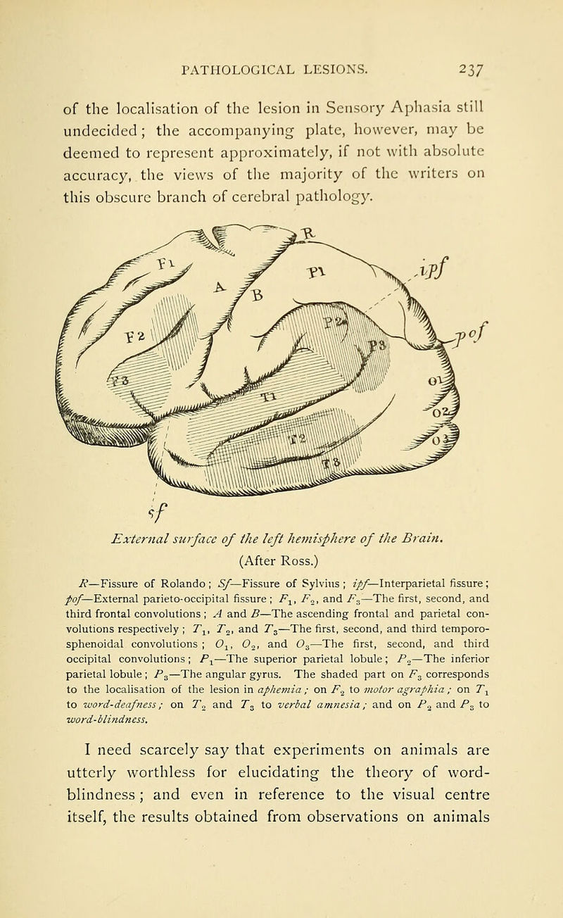 of the localisation of the lesion in Sensory Aphasia still undecided; the accompanying plate, however, may be deemed to represent approximately, if not with absolute accuracy, the views of the majority of the writers on this obscure branch of cerebral pathology. External suifacc of the left hemisphere of the Brain. (After Ross.) R—Fissure of Rolando ; Sf— Fissure of Sylvius ; zj#/^Interparietal fissure ; pof— External parieto-occipital fissure ; Flt F„, and Fs—The first, second, and third frontal convolutions ; A and B—The ascending frontal and parietal con- volutions respectively ; Tlt T2, and Ts—The first, second, and third temporo- sphenoidal convolutions ; Ox, 02, and 03—The first, second, and third occipital convolutions ; Px—The superior parietal lobule ; P„—The inferior parietal lobule; P3—The angular gyrus. The shaded part on F3 corresponds to the localisation of the lesion in aphemia ; on F2 to motor agraphia ; on 7\ to word-deafness; on T2 and 73 to verbal amnesia; and on P% and P& to word-blindness. I need scarcely say that experiments on animals are utterly worthless for elucidating the theory of word- blindness ; and even in reference to the visual centre itself, the results obtained from observations on animals