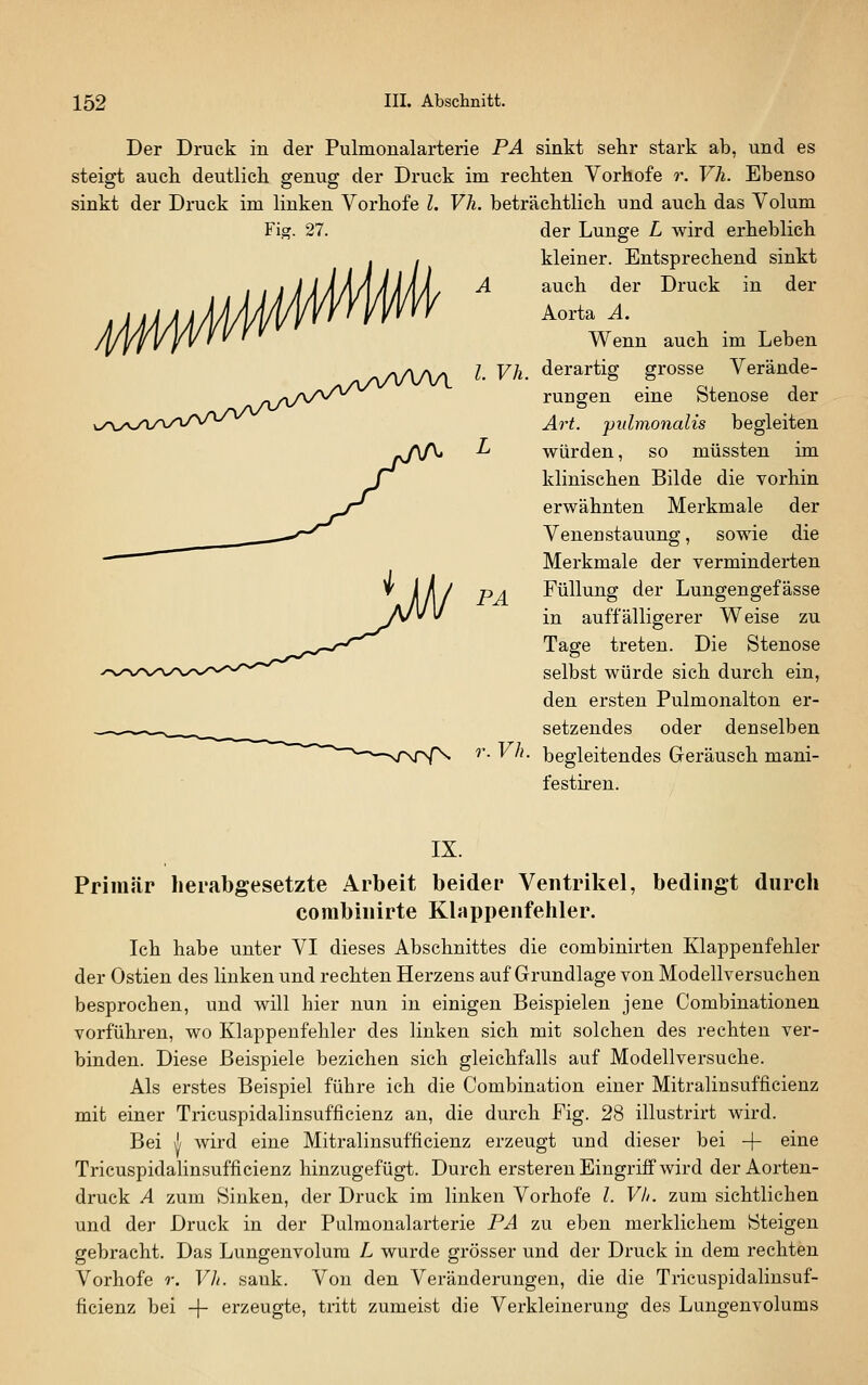 Der Druck in der Pulmonalarterie PA sinkt sehr stark ab, und es steigt auch deutlich genug der Druck im rechten Vorhofe r. Vh. Ebenso sinkt der Druck im linken Vorhofe l. Vh. beträchtlich und auch das Volum Fig. 27. l Vh. PA der Lunge L wird erheblich kleiner. Entsprechend sinkt auch der Druck in der Aorta A. Wenn auch im Leben derartig grosse Verände- rungen eine Stenose der Art. pulmonalis begleiten würden, so müssten im klinischen Bilde die vorhin erwähnten Merkmale der Venen Stauung, sowie die Merkmale der verminderten Füllung der Lungengefässe in auffälligerer Weise zu Tage treten. Die Stenose selbst würde sich durch ein, den ersten Pulmonalton er- setzendes oder denselben ^^'- begleitendes Greräusch mani- festiren. IX. Primär herabgesetzte Arbeit beider Ventrikel, bedingt durch combinirte Klappenfehler. Ich habe unter VI dieses Abschnittes die combinirten Klappenfehler der Ostien des linken und rechten Herzens auf Grundlage von Modellversuchen besprochen, und will hier nun in einigen Beispielen jene Combinationen vorführen, wo Klappenfehler des linken sich mit solchen des rechten ver- binden. Diese Beispiele bezichen sich gleichfalls auf Modellversuche. Als erstes Beispiel führe ich die Combination einer Mitralinsufficienz mit einer Tricuspidalinsufficienz an, die durch Fig. 28 illustrirt wird. Bei A wird eine Mitralinsufficienz erzeugt und dieser bei -[- eine Tricuspidalinsufficienz hinzugefügt. Durch ersteren Eingriff wird der Aorten- druck A zum Sinken, der Druck im linken Vorhofe l. Vh. zum sichtlichen und der Druck in der Pulmonalarterie PA zu eben merklichem Steigen gebracht. Das Lungenvolum L wurde grösser und der Druck in dem rechten Vorhofe r. Vh. sank. Von den Veränderungen, die die Tricuspidalinsuf- ficienz bei -\- erzeugte, tritt zumeist die Verkleinerung des Lungenvolums