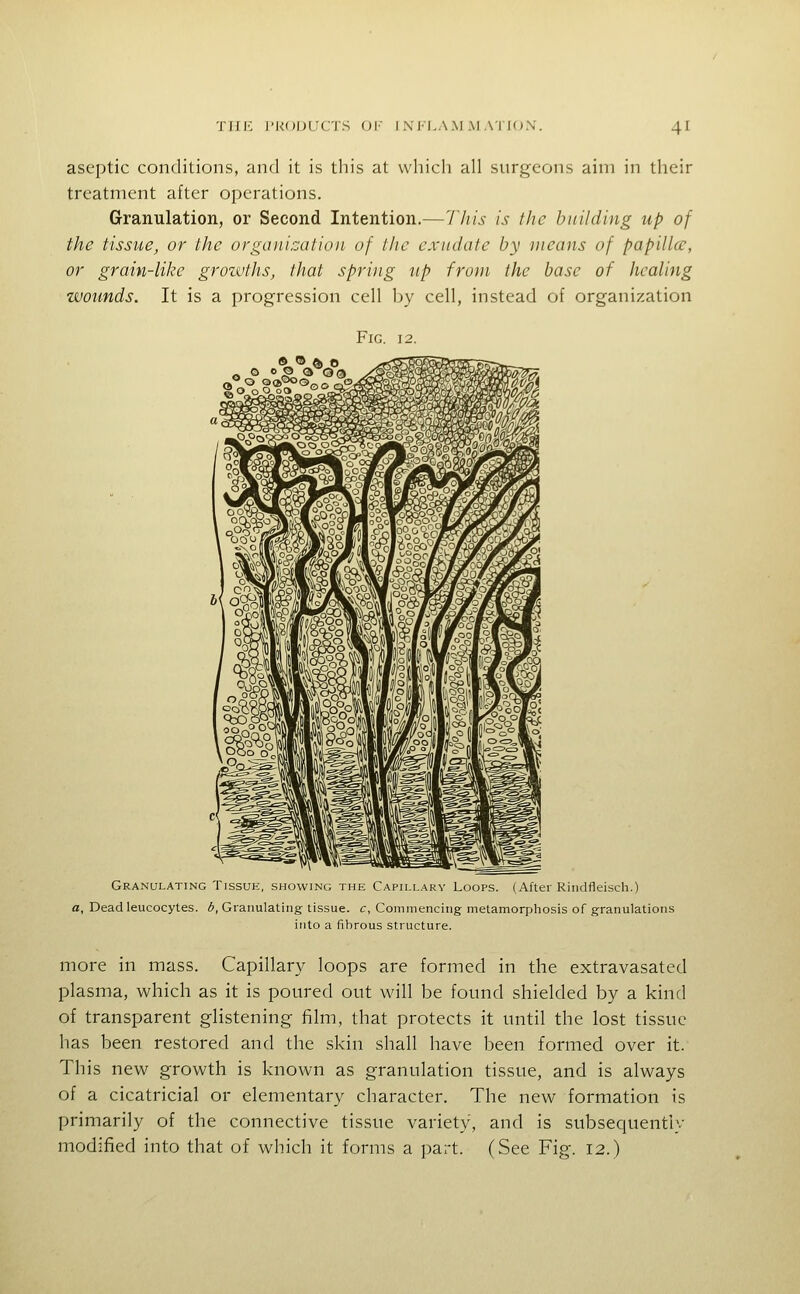 aseptic conditions, and it is this at which all surgeons aim in their treatment after operations. Grranulation, or Second Intention.—I'liis is the building up of the tissue, or the organization of the exudate by means of papillcc, or grain-like grozvths, that spring up from the base of healing zvounds. It is a progression cell by cell, instead of organization Fig. 12. Granulating Tissuh, .showing the Capillary Loops. (After Riiidfleisch.) a, Dead leucocytes. 6, Granulating tissue, c, Commencing metamorphosis of granulations into a fibrous structure. more in mass. Capillary loops are formed in the extravasated plasma, which as it is poured out will be found shielded by a kind of transparent glistening film, that protects it until the lost tissue has been restored and the skin shall have been formed over it. This new growth is known as granulation tissue, and is always of a cicatricial or elementary character. The new formation is primarily of the connective tissue variety, and is subsequently modified into that of which it forms a part. (See Fig. 12.)