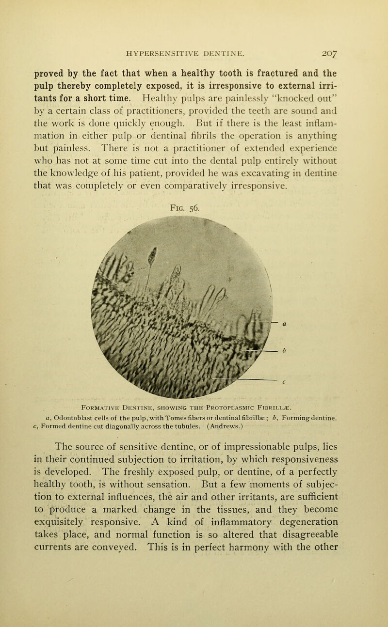 proved by the fact that when a healthy tooth is fractured and the pulp thereby completely exposed, it is irresponsive to external irri- tants for a short time. Healthy pulps are painlessly knocked out by a certain class of practitioners, provided the teeth are sound and the work is done quickly enough. But if there is the least inflam- mation in either pulp or dentinal fibrils the operation is anything but painless. There is not a practitioner of extended experience who has not at some time cut into the dental pulp entirely without the knowledge of his patient, provided he was excavating in dentine that was completely or even comparatively irresponsive. Fig. 56. # Formative Dentine, showing the Protoplasmic Fibrill^e. a, Odontoblast cells of the pulp, with Tomes fibers or dentinal fibrillse ; 6, Forming dentine. c, Formed dentine cut diagonally across the tubules. (Andrews.) The source of sensitive dentine, or of impressionable pulps, lies in their continued subjection to irritation, by which responsiveness is developed. The freshly exposed pulp, or dentine, of a perfectly healthy tooth, is without sensation. But a few moments of subjec- tion to external influences, the air and other irritants, are sufficient to produce a marked change in the tissues, and they become exquisitely responsive. A kind of inflammatory degeneration takes place, and normal function is so altered that disagreeable currents are conveyed. This is in perfect harmony with the other