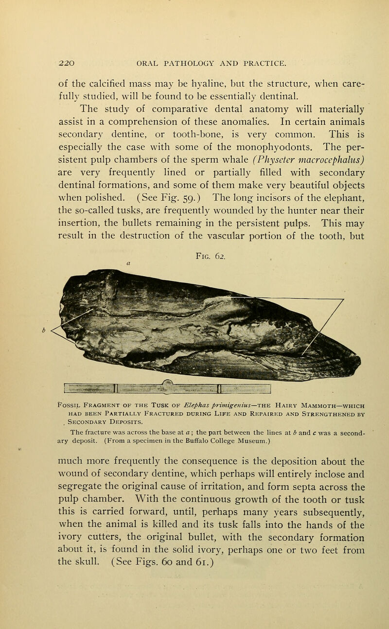 of the calcified mass may be hyaline, but the structure, when care- fully studied, will be found to be essentially dentinal. The study of comparative dental anatomy will materially assist in a comprehension of these anomalies. In certain animals secondary dentine, or tooth-bone, is very common. This is especially the case with some of the monophyodonts. The per- sistent pulp chambers of the sperm whale (Physeter macrocephalus) are very frequently lined or partially filled with secondary dentinal formations, and some of them make very beautiful objects when polished. (See Fig. 59.) The long incisors of the elephant, the so-called tusks, are frequently wounded by the hunter near their insertion, the bullets remaining in the persistent pulps. This may result in the destruction of the vascular portion of the tooth, but Fig. 62. Fossil Fragment of the Tusk of Elephas primigenius—TRK Hairy Mammoth—which had been partially fractured during life and repaired and strengthened by Secondary Deposits. The fracture was across the base at a ; the part between the lines at b and c was a second- ary deposit. (From a specimen in the Buffalo College Museum.) much more frequently the consequence is the deposition about the wound of secondary dentine, which perhaps will entirely inclose and segregate the original cause of irritation, and form septa across the pulp chamber. With the continuous growth of the tooth or tusk this is carried forward, until, perhaps many years subsequently, when the animal is killed and its tusk falls into the hands of the ivory cutters, the original bullet, with the secondary formation about it, is found in the solid ivory, perhaps one or two feet from the skull. (See Figs. 60 and 61.)