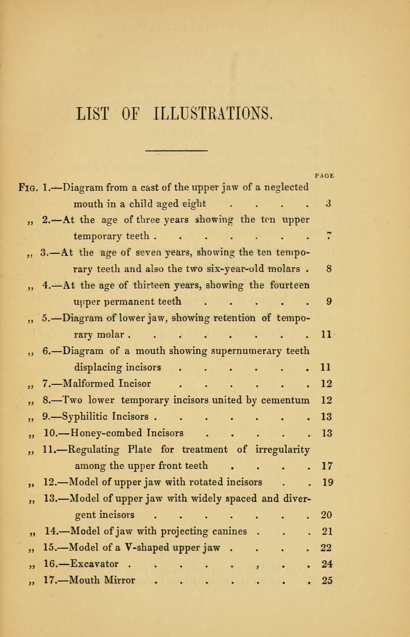 LIST OF ILLUSTRATIONS. Fig. 1.—Diagram from a cast of the upper jaw of a neglected mouth in a child aged eight .... 3 „ 2.—At the age of three years showing the ten upper temporary teeth ....... 7 ,, 3.—At the age of seven years, showing the ten tempo- rary teeth and also the two six-year-old molars . 8 ,, 4.—At the age of thirteen years, showing the fourteen upper permanent teeth ..... 9 ,, 5.—Diagram of lower jaw, showing retention of tempo- rary molar . . . . . . . .11 ,, 6.—Diagram of a mouth showing supernumerary teeth displacing incisors . . . . . .11 „ 7.—Malformed Incisor ...... 12 ,, 8.—Two lower temporary incisors united by cementum 12 ,, 9.—Syphilitic Incisors . . . . . . .13 „ 10.— Honey-combed Incisors . . . . .13 „ 11.—Regulating Plate for treatment of irregularity among the upper front teeth . . . .17 „ 12.—Model of upper jaw with rotated incisors . . 19 ,, 13.—Model of upper jaw with widely spaced and diver- gent incisors ....... 20 „ 14.—Model of jaw with projecting canines . . .21 „ 15.—Model of a V-shaped upper jaw . . . .22 „ 16.—Excavator ........ 24 ., 17.—Mouth Mirror 25