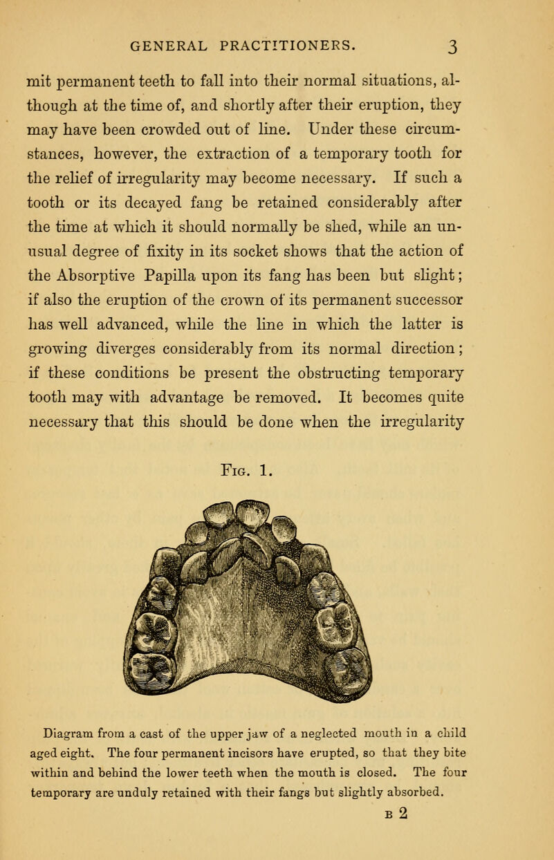 mit permanent teeth to fall into their normal situations, al- though at the time of, and shortly after their eruption, they may have been crowded out of line. Under these circum- stances, however, the extraction of a temporary tooth for the relief of irregularity may become necessary. If such a tooth or its decayed fang be retained considerably after the time at which it should normally be shed, while an un- usual degree of fixity in its socket shows that the action of the Absorptive Papilla upon its fang has been but slight; if also the eruption of the crown of its permanent successor has well advanced, while the line in which the latter is growing diverges considerably from its normal direction; if these conditions be present the obstructing temporary tooth may with advantage be removed. It becomes quite necessary that this should be done when the irregularity Fig. 1. Diagram from a cast of the upper jaw of a neglected mouth iu a child aged eight. The four permanent incisors have erupted, so that they bite within and behind the lower teeth when the mouth is closed. The four temporary are unduly retained with their fangs but slightly absorbed. b2