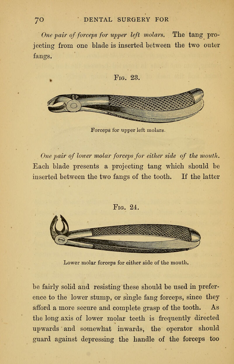 One pair of forceps for upper left molars. The tang pro- jecting from one blade is inserted between the two outer fangs. Fig. 23. Forceps for upper left molars. One pair of lower molar forceps for either side of the mouth. Each blade presents a projecting tang which should be inserted between the two fangs of the tooth. If the latter Fig. 24. Lower molar forceps for either side of the mouth. be fairly solid and resisting these should be used in prefer- ence to the lower stump, or single fang forceps, since they afford a more secure and complete grasp of the tooth. As the long axis of lower molar teeth is frequently directed upwards and somewhat inwards, the operator should guard against depressing the handle of the forceps too