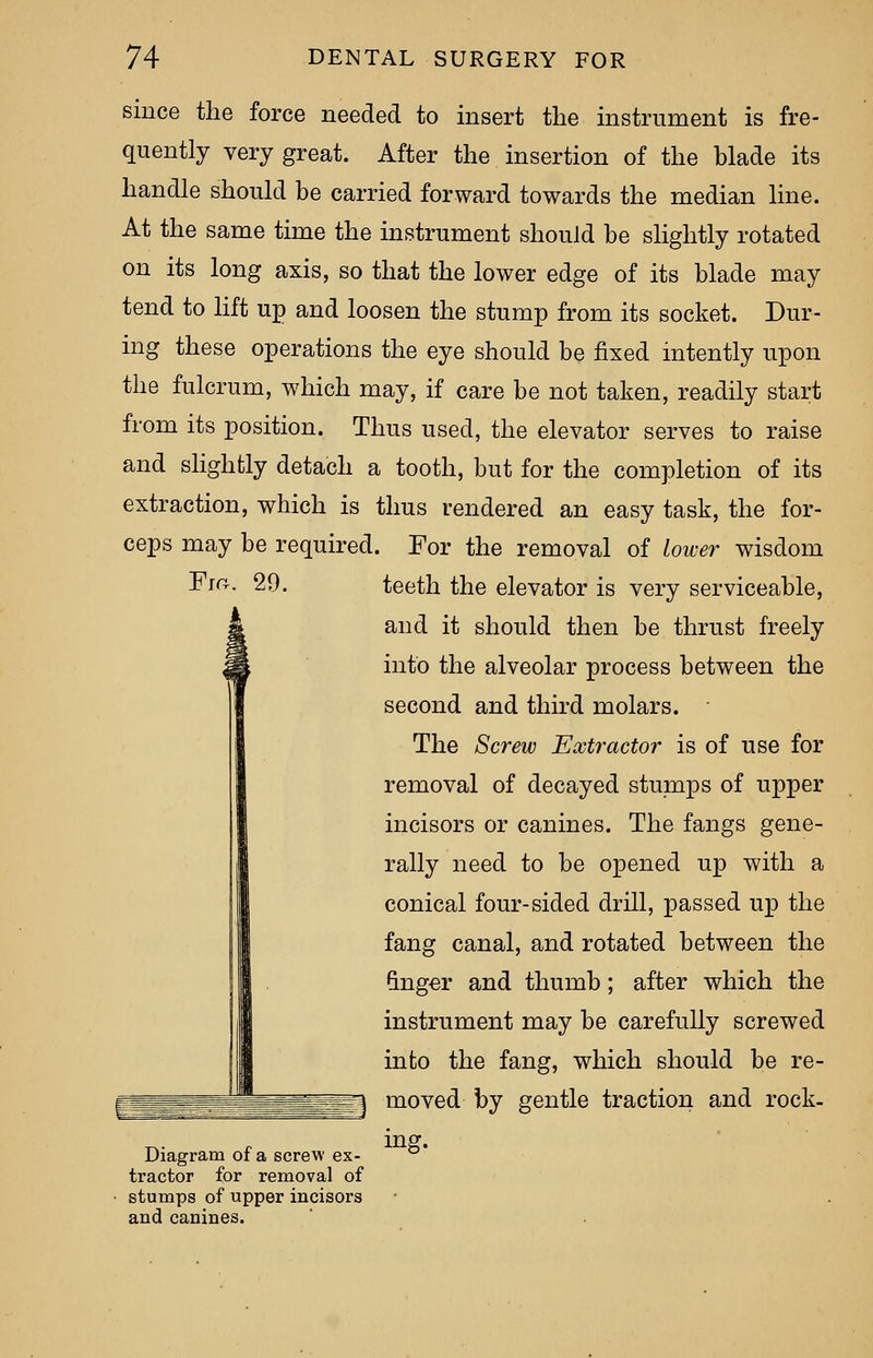 since the force needed to insert the instrument is fre- quently very great. After the insertion of the blade its handle should be carried forward towards the median line. At the same time the instrument should be slightly rotated on its long axis, so that the lower edge of its blade may tend to lift up and loosen the stump from its socket. Dur- ing these operations the eye should be fixed intently upon the fulcrum, which may, if care be not taken, readily start from its position. Thus used, the elevator serves to raise and slightly detach a tooth, but for the completion of its extraction, which is thus rendered an easy task, the for- ceps may be required. For the removal of lower wisdom Fia. 29. teeth the elevator is very serviceable, and it should then be thrust freely into the alveolar process between the second and third molars. The Screw Extractor is of use for removal of decayed stumps of upper incisors or canines. The fangs gene- rally need to be opened up with a conical four-sided drill, passed up the fang canal, and rotated between the anger and thumb; after which the instrument may be carefully screwed into the fang, which should be re- moved by gentle traction and rock- Diagram of a screw ex- tractor for removal of stumps of upper incisors and canines. ing.