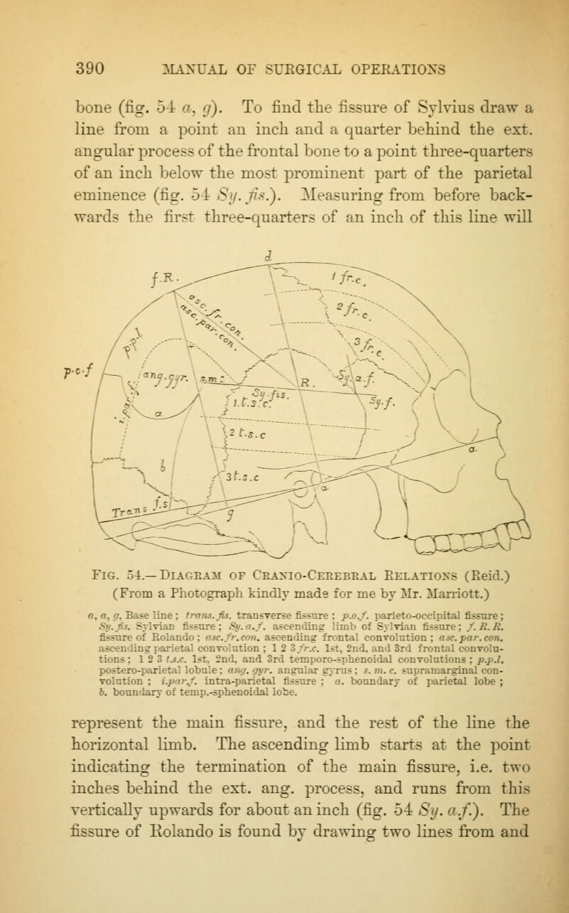 bone (fig. 54 a, g). To find the fissure of Sylvius draw a line from a point an inch and a quarter behind the ext. angular process of the frontal bone to a point three-quarters of an inch below the most prominent part of the parietal eminence (fig. 54 Sy.fisl). Measuring from before back- wards the first three-quarters of an inch of this line will Fig. 54.—Diagram of Craniocerebral Relations (Pieid.) (From a Photograph kindly made for me by Mr. Marriott.) o, a, a. Base line ; trans, fis. transverse fissure : p.o.f. parieto-oeeipital fissure ; fU. SylviaD fissu: : S . ./. ascending limb of Sylvian fissure: /.1LR. fissure of Rolando: ascfr.con, ascending frontal convolution: ate. par. eon. ascending parietal convolution : 1 2 3/r.c. 1st. 2nd, and 3rd frontal convolu- tions : 1 2 3 t^.c. 1st. 2nd, and 3rd temporo-sphenoidal convolutions ; p.pJ. postero-parietal lobu'.e: <i.u>j. gyr. angular gyrus : s. m. c. supraniarginal con- volution : /. intra-parietal fissure ; a. boundary of parietal lobe ; b. boundary of temp.-sphenoidal lc represent the main fissure, and the rest of the line the horizontal limb. The ascending limb starts at the point indicating the termination of the main fissure, i.e. two inches behind the ext. ang. process, and runs from this vertically upwards for about an inch (fig. 54 Sy. a./.). The fissure of Rolando is found by drawing two lines from and