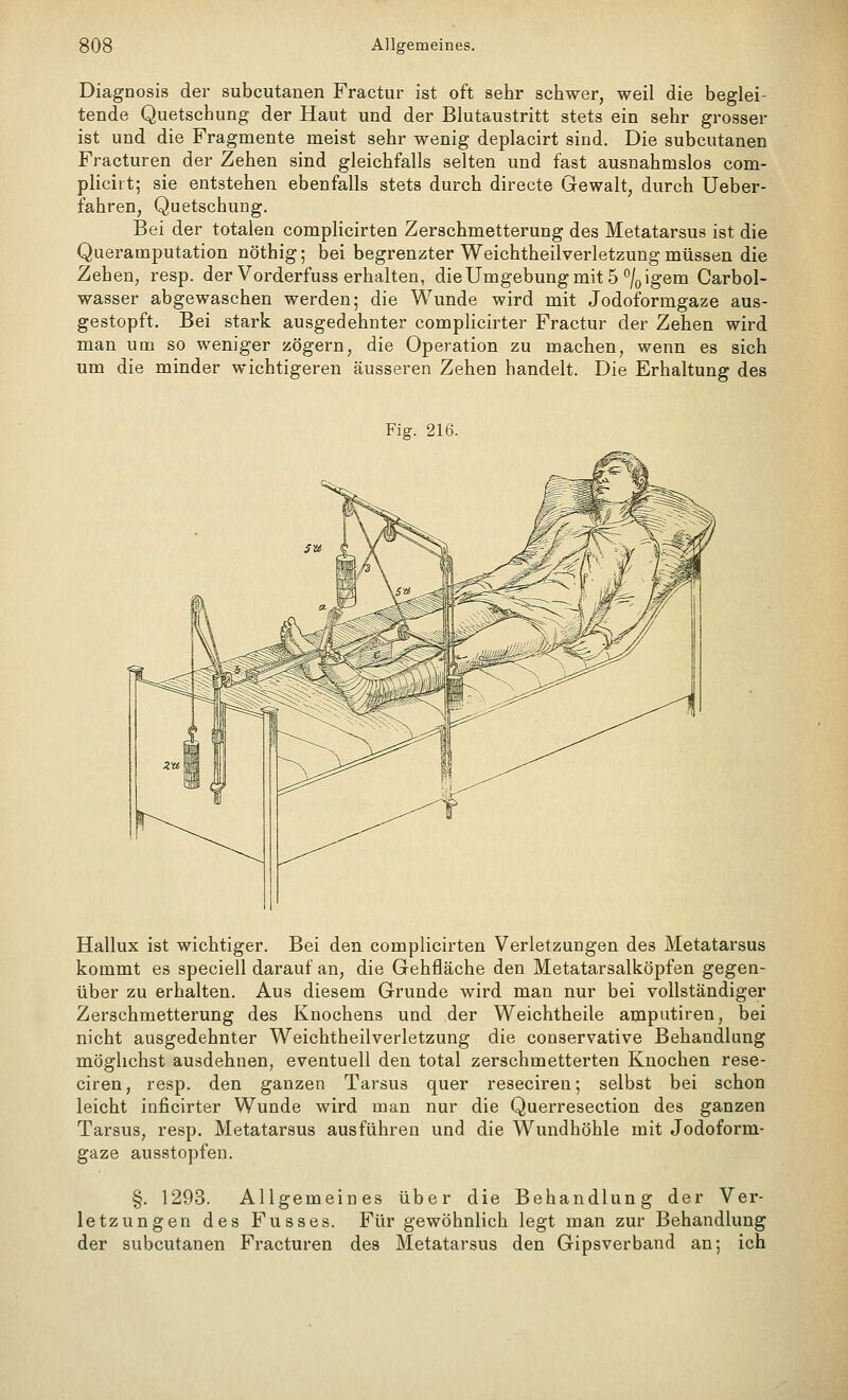 Diagnosis der subcutanen Fractur ist oft sehr schwer, weil die beglei- tende Quetschung der Haut und der Blutaustritt stets ein sehr grosser ist und die Fragmente meist sehr wenig deplacirt sind. Die subcutanen Fracturen der Zehen sind gleichfalls selten und fast ausnahmslos com- plicitt; sie entstehen ebenfalls stets durch directe Gewalt, durch Ueber- fahren, Quetschung. Bei der totalen complicirten Zerschmetterung des Metatarsus ist die Qiieramputation nöthig; bei begrenzter Weichtheilverletzung müssen die Zehen, resp. der Vorderfuss erhalten, dieUmgebungmit 5 %igem Carbol- wasser abgewaschen werden; die Wunde wird mit Jodoformgaze aus- gestopft. Bei stark ausgedehnter complicirter Fractur der Zehen wird man um so weniger zögern, die Operation zu machen, wenn es sich um die minder wichtigeren äusseren Zehen handelt. Die Erhaltung des Fig. 216. Hallux ist wichtiger. Bei den complicirten Verletzungen des Metatarsus kommt es speciell darauf an, die Gehfläche den Metatarsalköpfen gegen- über zu erhalten. Aus diesem Grunde wird man nur bei vollständiger Zerschmetterung des Knochens und der Weichtheile amputiren, bei nicht ausgedehnter Weichtheilverletzung die conservative Behandlung möglichst ausdehnen, eventuell den total zerschmetterten Knochen rese- ciren, resp. den ganzen Tarsus quer reseciren; selbst bei schon leicht inficirter Wunde wird man nur die Querresection des ganzen Tarsus, resp. Metatarsus ausführen und die Wundhöhle mit Jodoform- gaze ausstopfen. §. 1293. Allgemeines über die Behandlung der Ver- letzungen des Fusses. Für gewöhnlich legt man zur Behandlung der subcutanen Fracturen des Metatarsus den Gipsverband an; ich