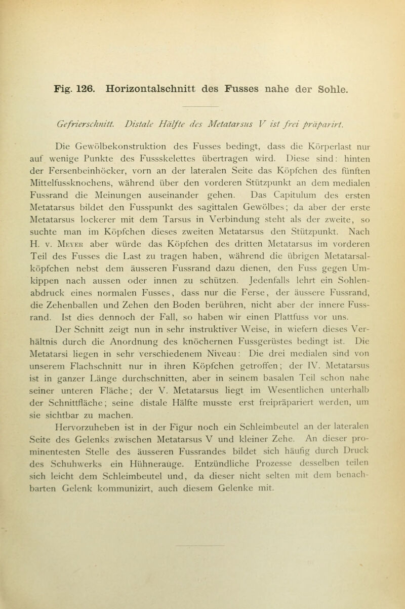 Gefrierschnitt. Distale Hälfte des Metatarsiis V ist frei präparirt. Die Gewülbekonstruktion des Fusses bedingt, dass die Körperlast nur auf wenige Punkte des Fussskelettes übertragen wird. Diese sind: hinten der Fersenbeinhöcker, vorn an der lateralen Seite das Köpfchen des Rinften Mittelfussknochens, während über den vorderen Stützpunkt an dem medialen Fussrand die Meinungen auseinander gehen. Das Capitulum des ersten IMetatarsus bildet den Fusspunkt des sagittalen Gewölbes; da aber der erste Metatarsus lockerer mit dem Tarsus in Verbindung steht als der zweite, so suchte man im Köpfchen dieses zweiten Metatarsus den Stützpunkt. Nach H. V. Meyee aber würde das Köpfchen des dritten Metatarsus im vorderen Teil des Fusses die Last zu tragen haben, während die übrigen Metatarsal- köpfchen nebst dem äusseren Fussrand dazu dienen, den Fuss gegen Um- kippen nach aussen oder innen zu schützen. Jedenfalls lehrt ein Sohlen- abdruck eines normalen Fusses, dass nur die Ferse, der äussere Fussrand, die Zehenballen und Zehen den Boden berühren, nicht aber der innere Fuss- rand. Ist dies dennoch der Fall, so haben wir einen Plattfuss vor uns. Der Schnitt zeigt nun in sehr instruktiver Weise, in wiefern dieses Ver- hältnis durch die Anordnung des knöchernen Fussgerüstes bedingt ist. Die Metatarsi liegen in sehr verschiedenem Niveau: Die drei medialen sind von unserem Flachschnitt nur in ihren Köpfchen getroffen; der IV. Metatarsus ist in ganzer Länge durchschnitten, aber in seinem basalen Teil schon nahe seiner unteren Fläche; der V. Metatarsus liegt im Wesentlichen unterhalb der Schnittfläche; seine distale Hälfte musste erst freipräpariert werden, um sie sichtbar zu machen. Hervorzuheben ist in der Figur noch ein Schleimbcutel an der lateralen Seite des Gelenks zwischen Metatarsus V und kleiner Zehe. An dieser pro- minentesten Stelle des äusseren Fussrandes bildet sich häufig durch Druck des Schuhwerks ein Hühnerauge. Entzündliche Prozesse desselben teilen sich leicht dem Schleimbeutel und, da dieser nicht selten mit dem benach- barten Gelenk kommunizirt, auch diesem Gelenke mit.