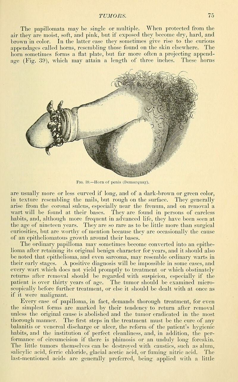 The papillomata may be single or multiple. When protected from the air they are moist, soft, and pink, but if exposed they become dry, hard, and brown in color. In the latter case they sometimes give rise to the curious appendages called horns, resembling those found on the skin elsewhere. The horn sometimes forms a flat plate, but far more often a projecting append- age (Fig. 39), which may attain a length of three inches. These horns in, V' lllP^ Fig. 39.—Horn of penis (Demarquay). are usually more or less curved if long, and of a dark-brown or green color, in texture resembling the nails, but rough on the surface. They generally arise from the coronal sulcus, especially near the frenum, and on removal a wart will be found at their bases. They are found in persons of careless habits, and, although more frequent in advanced life, they have been seen at the age of nineteen years. They are so rare as to be little more than surgical curiosities, but are worthy of mention because they are occasionally the cause of an epitheliomatous growth around their bases. The ordinary papilloma may sometimes become converted into an epithe- lioma after retaining its original benign character for years, and it should also be noted that epithelioma, and even sarcoma, may resemble ordinary warts in their early stages. A positive diagnosis will be impossible in some cases, and every wart which does not yield promptly to treatment or which obstinately returns after removal should be regarded with suspicion, especially if the patient is over thirty years of age. The tumor should be examined micro- scopically before further treatment, or else it should be dealt with at once as if it were malignant. Every case of papilloma, in fact, demands thorough treatment, for even the simplest forms are marked by their tendency to return after removal unless the original cause is abolished and the tumor eradicated in the most thorough manner. The first steps in the treatment must be the cure of any balanitis or venereal discharge or ulcer, the reform of the patient's hygienic habits, and the institution of perfect cleanliness, and, in addition, the per- formance of circumcision if there is phimosis or an unduly long foreskin. The little tumors themselves can be destroyed with caustics, such as alum, salicylic acid, ferric chloride, glacial acetic acid, or fuming nitric acid. The last-mentioned acids are generally jn'eferred, being applied with a little