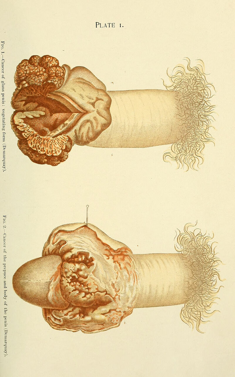 Plate i.