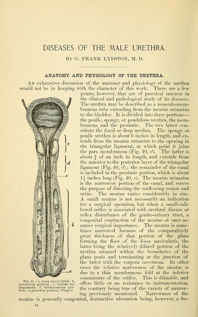 DISEASES OF THE MALE URETHRA. By G. FRANK LYDSTON, M. D. ANATOMY AND PHYSIOLOGY OF THE URETHRA. An exhaustive discussion of the anatomy and physiology of the urethra would not be in keeping with the character of this work. There are a few points, however, that are of practical interest in the clinical and pathological study of its diseases. The urethra may be described as a musculo-mem- branous tube extending from the meatus urinarius to the bladder. It is divided into three portions— the penile, spongy, or pendulous urethra, the mem- branous, and the prostatic. The two latter con- stitute the fixed or deep urethra. The spongy or penile urethra is about 6 inches in length, and ex- tends from the meatus urinarius to the opening in the triangular ligament, at which point it joins the pars niernbranosa (Fig. 40, d). The latter is about -J of an inch in length, and extends from the anterior to the posterior layer of the triangular ligament (Fig. 40, d) ; the remainder of the canal is included in the prostatic portion, which is about 11 inches long (Fig. 40, e). The meatus urinarius is the narrowest portion of the canal, and serves the purpose of directing the outflowing semen and urine. The meatus varies considerably in size. A small meatus is not necessarily an indication for a surgical operation, but when a small-cali- bered orifice is associated with urethral disease or reflex disturbance of the genito-urinary tract, a congenital contraction of the meatus at once as- sumes surgical importance. The meatus is some- times narrowed because of the comparatively great thickness of that portion of the glans forming the floor of the fossa navicularis, the latter being the relatively dilated portion of the urethra situated within the boundaries of the glans penis and terminating at the junction of the latter with the corpora cavernosa. In other cases the relative narrowness of the meatus is due to a thin membranous fold at the inferior commissure of the orifice. This is dilatable, and offers little or no resistance to instrumentation, the contrary being true of the variety of narrow- ing previously mentioned. Narrowness of the meatus is generally congenital, destructive ulceration being, however, a fre- 84 Fig. 40 —a, fossa navicularis ; bt cavernous portion ; c, bulbar en- largement; d, membranous por- tion : e, prostatic portion (Finger).