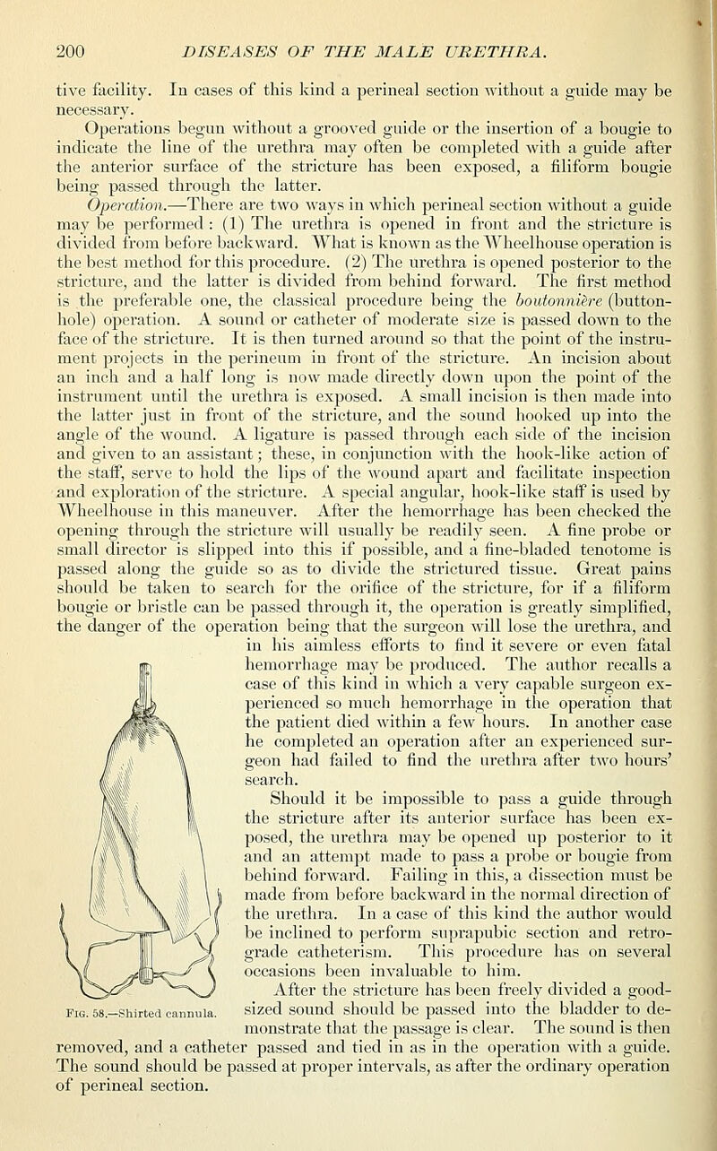 tive facility. In cases of this kind a perineal section without a guide may be necessary. Operations begun without a grooved guide or the insertion of a bougie to indicate the line of the urethra may often be completed with a guide after the anterior surface of the stricture has been exposed, a filiform bougie being passed through the latter. Operation.—There are two ways in which perineal section without a guide may be performed : (1) The urethra is opened in front and the stricture is divided from before backward. What is known as the Wheelhouse operation is the best method for this procedure. (2) The urethra is opened posterior to the stricture, and the latter is divided from behind forward. The first method is the preferable one, the classical procedure being the boutonniere (button- hole) operation. A sound or catheter of moderate size is passed down to the face of the stricture. It is then turned around so that the point of the instru- ment pi'ojects in the perineum in front of the stricture. An incision about an inch and a half long is now made directly down upon the point of the instrument until the urethra is exposed. A small incision is then made into the latter just in front of the stricture, and the sound hooked up into the angle of the wound. A ligature is passed through each side of the incision and given to an assistant; these, in conjunction with the hook-like action of the staff, serve to hold the lips of the wound apart and facilitate inspection and exploration of the stricture. A special angular, hook-like staff is used by Wheelhouse in this maneuver. After the hemorrhage has been checked the opening through the stricture will usually be readily seen. A fine probe or small director is slipped into this if possible, and a fine-bladed tenotome is passed along the guide so as to divide the strictured tissue. Great pains should be taken to search for the orifice of the stricture, for if a filiform bougie or bristle can be passed through it, the operation is greatly simplified, the danger of the operation being that the surgeon will lose the urethra, and in his aimless efforts to find it severe or even fatal hemorrhage may be produced. The author recalls a case of this kind in which a very capable surgeon ex- perienced so much hemorrhage in the operation that the patient died within a few hours. In another case he completed an operation after an experienced sur- geon had failed to find the urethra after two hours' search. Should it be impossible to pass a guide through the stricture after its anterior surface has been ex- posed, the urethra may be opened up posterior to it and an attempt made to pass a probe or bougie from behind forward. Failing in this, a dissection must be made from before backward in the normal direction of the urethra. In a case of this kind the author would be inclined to perform suprapubic section and retro- grade catheterism. This procedure has on several occasions been invaluable to him. After the stricture has been freely divided a good- sized sound should be passed into the bladder to de- monstrate that the passage is clear. The sound is then removed, and a catheter passed and tied in as in the operation with a guide. The sound should be passed at proper intervals, as after the ordinary operation of perineal section. Fig. 58.—Shirted cannula.