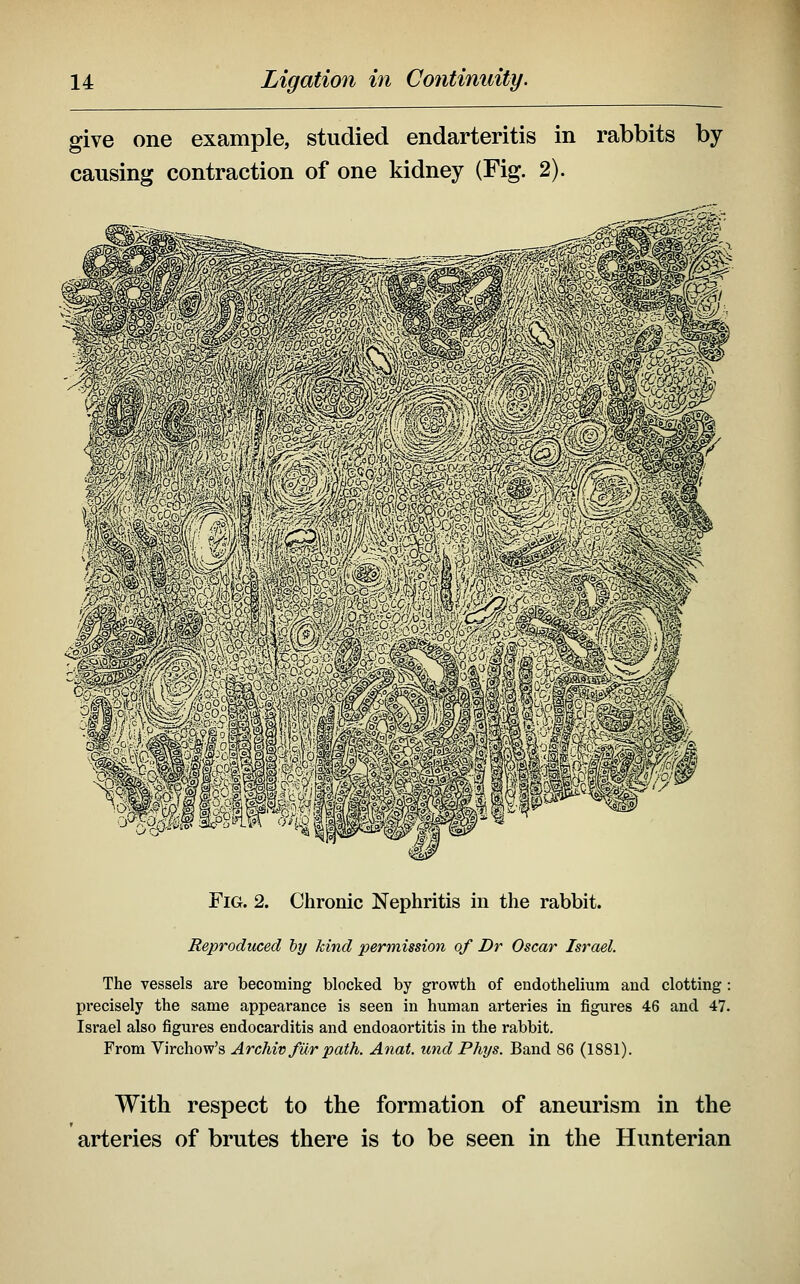 give one example, studied endarteritis in rabbits by causing contraction of one kidney (Fig. 2). Fig. 2. Chronic Nephritis in the rabbit. Reproduced by kind permission of Dr Oscar Israel. The vessels are becoming blocked by growth of endothelium and clotting: precisely the same appearance is seen in human arteries in figures 46 and 47. Israel also figures endocarditis and endoaortitis in the rabbit. From Virchow's Archiv fur path. Anat. und Phys. Band 86 (1881). With respect to the formation of aneurism in the arteries of brutes there is to be seen in the Hunterian