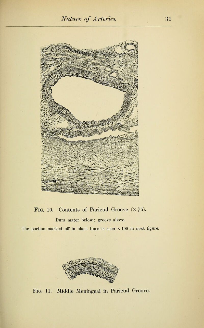 Fig. 10. Contents of Parietal Groove (x 75). Dura mater below; groove above. The portion marked off in black lines is seen x 100 in next figure. Fig. 11. Middle Meningeal in Parietal Groove.