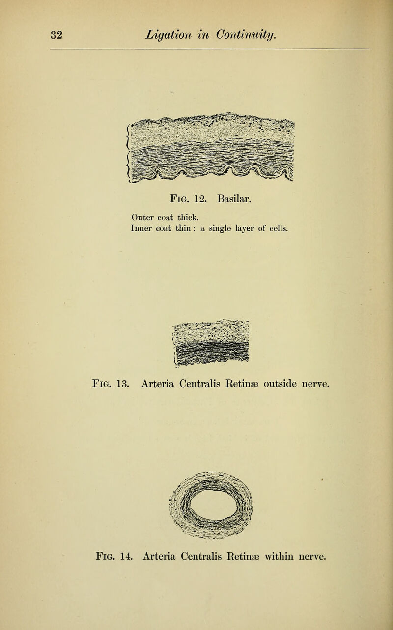 Fig. 12. Basilar. Outer coat thick. Inner coat thin: a single layer of cells. Fig. 13. Arteria Centralis Retinae outside nerve. Fig. 14. Arteria Centralis Retinse within nerve.