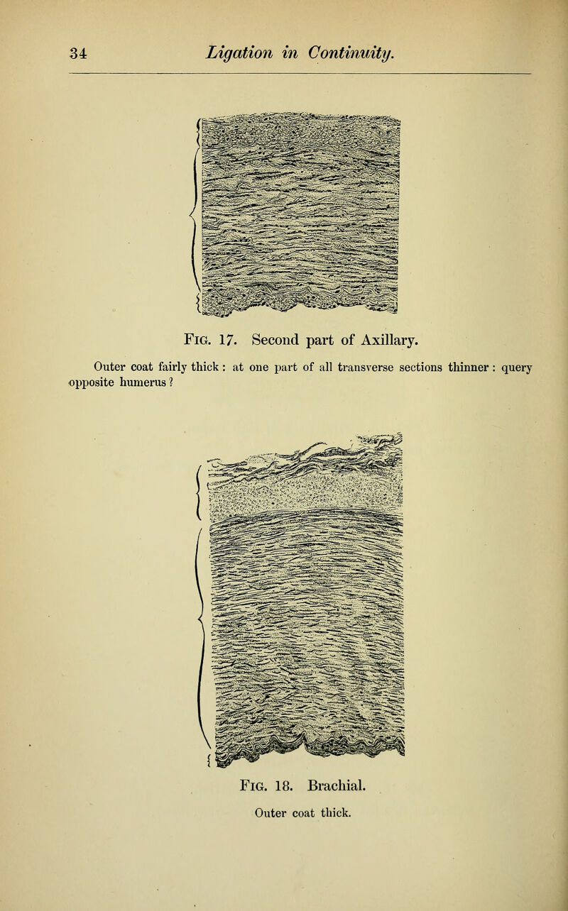 Fig. 17. Second part of Axillary. Outer coat fairly thick: at one part of all transverse sections thinner: query opposite humerus? Fig. 18. Brachial. Outer coat thick.