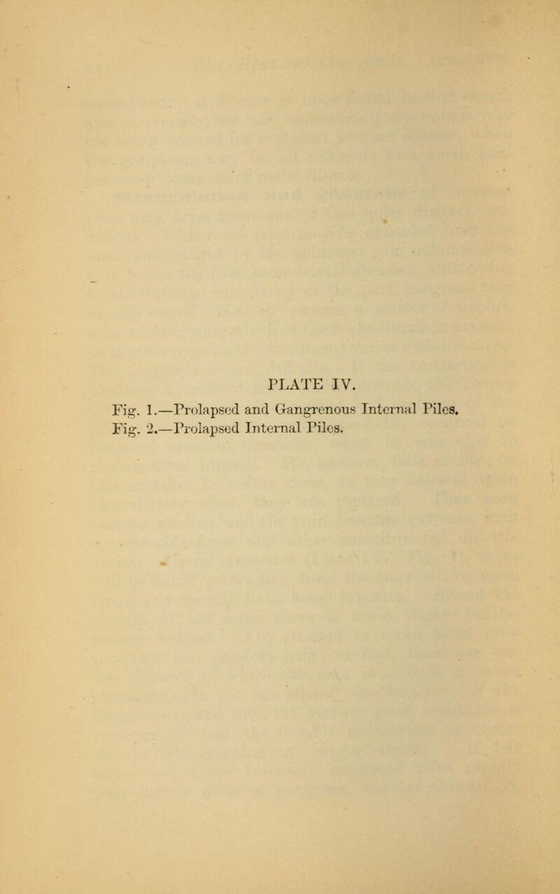 PLATE IV. Fig. 1.—Prolapsed and Gangrenous Intcinal Piles. Fig. 2.—Prolapsed Internal Piles.