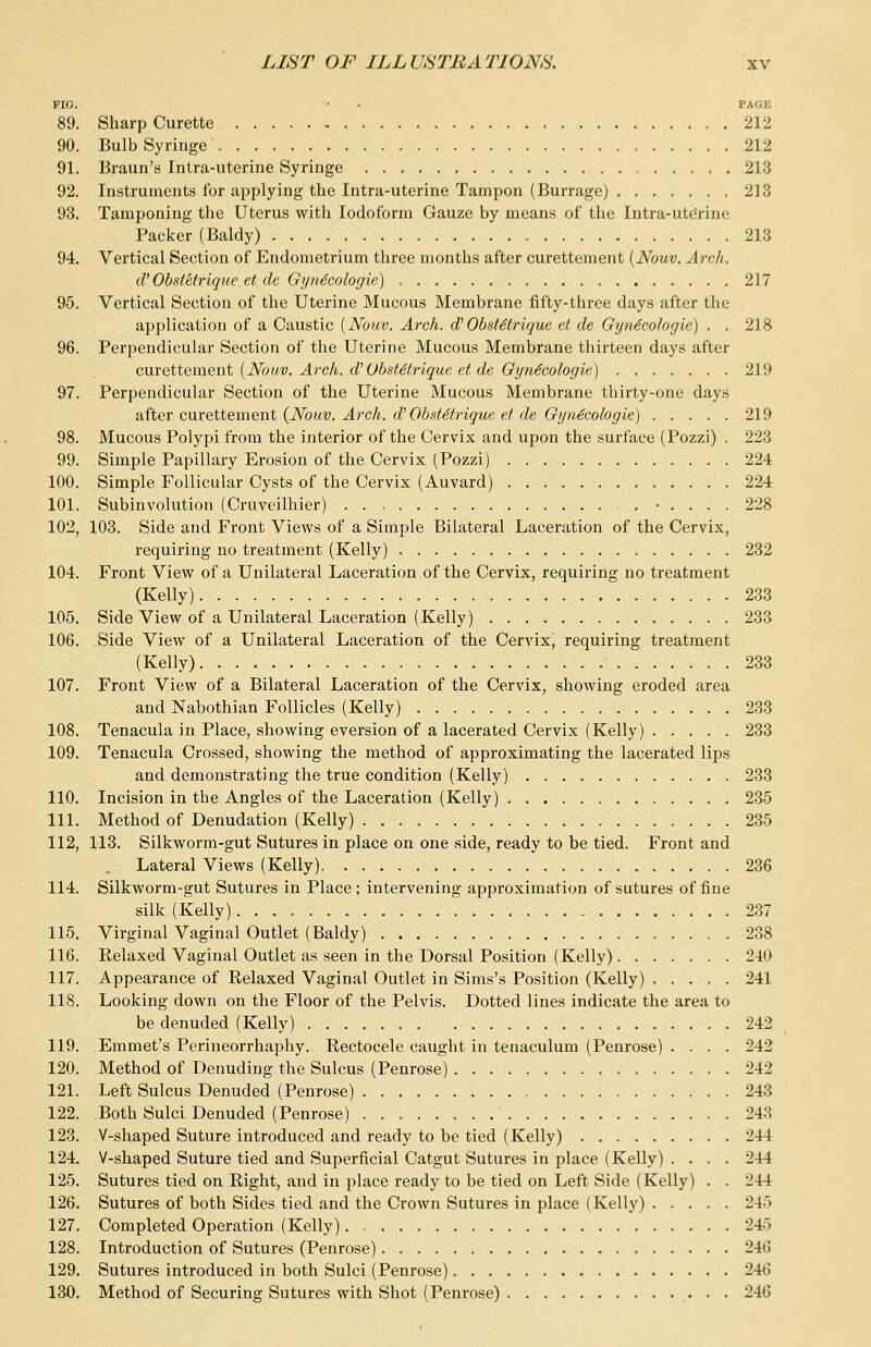 FIG. - • PACK 89. Sharp Curette 212 90. Bulb Syringe 212 91. Braun's Intra-uterine Syringe 213 92. Instruments for applying the Intra-uterine Tampon (Burrage) 213 93. Tamponing the Uterus with Iodoform Gauze by means of the Intra-ute*rine Packer (Baldy) 213 94. Vertical Section of Endometrium three months after curettement (Nouv. Arch. d'ObstMrlque et de Gynecologic) 217 95. Vertical Section of the Uterine Mucous Membrane fifty-three days after the application of a Caustic {Nouv. Arch. d'ObstMrique et de Gyn6cologie) . . 218 96. Perpendicular Section of the Uterine Mucous Membrane thirteen days after curettement (Nouv. Arch, d' ObsMtrique et de Gyne'cologie) 219 97. Perpendicular Section of the Uterine Mucous Membrane thirty-one days after curettement {Nouv. Arch, d'ObsMtrique et de Gyn6cologie) 219 98. Mucous Polypi from the interior of the Cervix and upon the surface (Pozzi) . 223 99. Simple Papillary Erosion of the Cervix (Pozzi) 224 100. Simple Follicular Cysts of the Cervix (Auvard) 224 101. Subinvolution (Cruveilhier) • .... 228 102. 103. Side and Front Views of a Simple Bilateral Laceration of the Cervix, requiring no treatment (Kelly) 232 104. Front View of a Unilateral Laceration of the Cervix, requiring no treatment (Kelly) 233 105. Side View of a Unilateral Laceration (Kelly) 233 106. Side View of a Unilateral Laceration of the Cervix, requiring treatment (Kelly) 233 107. Front View of a Bilateral Laceration of the Cervix, showing eroded area and Nabothian Follicles (Kelly) 233 108. Tenacula in Place, showing eversion of a lacerated Cervix (Kelly) 233 109. Tenacula Crossed, showing the method of approximating the lacerated lips and demonstrating the true condition (Kelly) 233 110. Incision in the Angles of the Laceration (Kelly) 235 111. Method of Denudation (Kelly) 235 112. 113. Silkworm-gut Sutures in place on one side, ready to be tied. Front and . Lateral Views (Kelly) 236 114. Silkworm-gut Sutures in Place; intervening approximation of sutures of fine silk (Kelly) 237 115. Virginal Vaginal Outlet (Baldy) 238 116. Relaxed Vaginal Outlet as seen in the Dorsal Position (Kelly) 240 117. Appearance of Relaxed Vaginal Outlet in Sims's Position (Kelly) 241 118. Looking down on the Floor of the Pelvis. Dotted lines indicate the area to be denuded (Kelly) 242 119. Emmet's Perineorrhaphy. Rectocele caught in tenaculum (Penrose) .... 242 120. Method of Denuding the Sulcus (Penrose) 242 121. Left Sulcus Denuded (Penrose) 243 122. Both Sulci Denuded (Penrose) 243 123. V-shaped Suture introduced and ready to be tied (Kelly) 244 124. V-shaped Suture tied and Superficial Catgut Sutures in place (Kelly) .... 244 125. Sutures tied on Right, and in place ready to be tied on Left Side (Kelly) . . 244 126. Sutures of both Sides tied and the Crown Sutures in place (Kelly) 245 127. Completed Operation (Kelly) 245 128. Introduction of Sutures (Penrose) 246 129. Sutures introduced in both Sulci (Penrose) 246 130. Method of Securing Sutures with Shot (Penrose) • • • 246