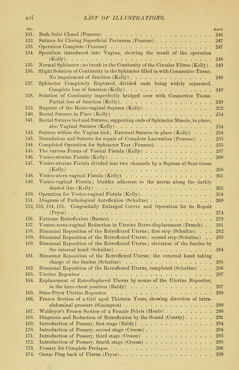 FIG. PAGE 131. Both Sulci Closed (Penrose) 246 132. Sutures for Closing Superficial Perineum (Penrose) 247 133. Operation Complete (Penrose) 247 134. Speculum introduced into Vagina, showing the result of the operation • (Kelly) 248 135. Normal Sphincter; no break in the Continuity of the Circular Fibres (Kelly) . 249 136. Slight Solution of Continuity in the Sphincter filled in with Connective Tissue. No impairment of function (Kelly) 249 137. Sphincter Completely Ruptured, divided ends being widely separated. Complete loss of function (Kelly) , 249 138. Solution of Continuity imperfectly bridged over with Connective Tissue. Partial loss of function (Kelly) 249 139. Eupture of the Recto-vaginal Septum (Kelly) 252 140. Rectal Sutures in Place (Kelly) 254 141. Rectal Sutures tied and Sutures, supporting ends of Sphincter Muscle, in place ; also Vaginal Sutures (Kelly) 254 142. Sutures within the Vagina tied ; External Sutures in place (Kelly) .... 254 143. Denudation and Sutures for repair of Complete Laceration (Penrose) . . . 255 144. Completed Operation for Sphincter Tear (Penrose) 255 145. The various Forms of Vesical Fistula (Kelly) 257 146. Vesico-uterine Fistula (Kelly) 260 147. Vesico-uterine Fistula divided into two channels by a Septum of Scar-tissue (Kelly) 260 148. Vesico-utero-vaginal Fistula (Kelly) 261 149. Vesico-vaginal Fistula; bladder adherent to the uterus along the darkly shaded line (Kelly) 263 150. Operation for Vesico-vaginal Fistula (Kelly) 264 151. Diagram of Pathological Anteflexion (Schultze) 269 152. 153, 154, 155. Congenitally Enlarged Cervix and Operation for its Repair (Pryor) 274 156. Extreme Retroflexion (Barnes) 279 157. Ventro-recto-vaginal Reduction in Uterine Retro-displacement (Brandt) . . 281 158. Bimanual Reposition of the Retroflexed Uterus; first step (Schultze) . . . 282 159. Bimanual Reposition of the Retroflexed Uterus; second step (Schultze) .. . 283 160. Bimanual Reposition of the Retroflexed Uterus; elevation of the fundus by the internal hand (Schultze) 284 161. Bimanual Reposition of the Retroflexed Uterus; the external hand taking charge of the fundus (Schultze) 285 162. Bimanual Reposition of the Retroflexed Uterus, completed (Schultze) . . . 286 163. Uterine Repositor 287 164. Replacement of Retrodisplaced Uterus by means of the Uterine Repositor, in the knee-chest position (Baldy) 287 165. Sims-Pryor Uterine Repositor 288 166. Frozen Section of a Girl aged Thirteen Years, showing direction of intra- abdominal pressure (Simington) 289 167. Waldeyer's Frozen Section of a Female Pelvis (Henle) 290 168. Diagnosis and Reduction of Retroflexion by the Sound (Courty) 291 169. Introduction of Pessary, first stage (Baldy) 294 170. Introduction of Pessary, second stage (Croom) 294 171. Introduction of Pessary, third stage (Croom) 295 172. Introduction of Pessary, fourth stage (Croom) 295 173. Pessary for Complete Prolapse 296 174. Gauze Plug back of Uterus (Pryor) 298