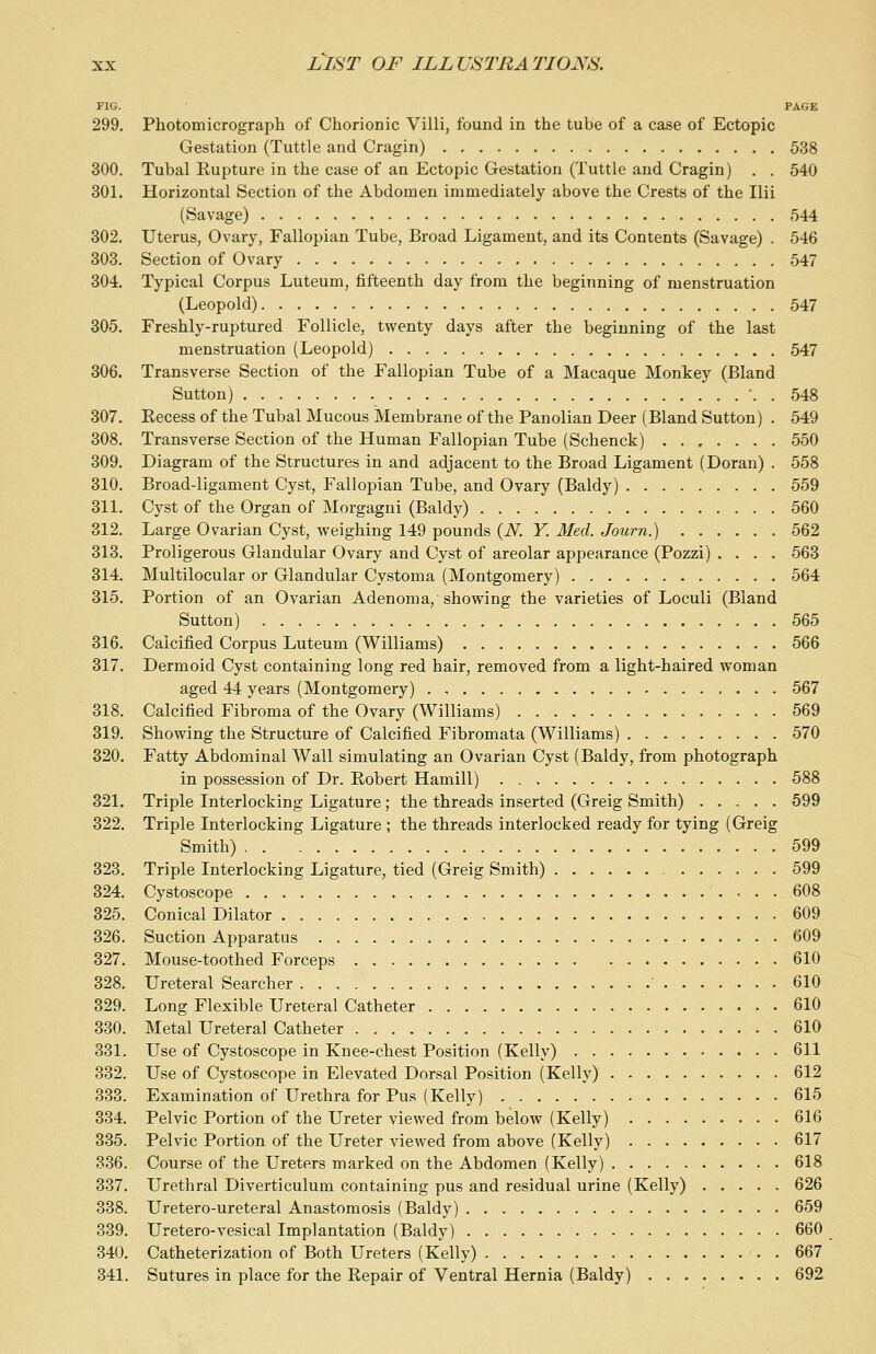 FIG. PAGE 299. Photomicrograph of Chorionic Villi, found in the tube of a case of Ectopic Gestation (Tuttle and Cragin) 538 300. Tubal Rupture in the case of an Ectopic Gestation (Tuttle and Cragin) . . 540 301. Horizontal Section of the Abdomen immediately above the Crests of the Ilii (Savage) 544 302. Uterus, Ovary, Fallopian Tube, Broad Ligament, and its Contents (Savage) . 546 303. Section of Ovary 547 304. Typical Corpus Luteum, fifteenth day from the beginning of menstruation (Leopold) 547 305. Freshly-ruptured Follicle, twenty days after the beginning of the last menstruation (Leopold) 547 306. Transverse Section of the Fallopian Tube of a Macaque Monkey (Bland Sutton) . 548 307. Eecess of the Tubal Mucous Membrane of the Panolian Deer (Bland Sutton) . 549 308. Transverse Section of the Human Fallopian Tube (Schenck) ....... 550 309. Diagram of the Structures in and adjacent to the Broad Ligament (Doran) . 558 310. Broad-ligament Cyst, Fallopian Tube, and Ovary (Baldy) 559 311. Cyst of the Organ of Morgagni (Baldy) 560 312. Large Ovarian Cyst, weighing 149 pounds (iV. Y. Med. Journ.) 562 313. Proligerous Glandular Ovary and Cyst of areolar appearance (Pozzi) .... 563 314. Multilocular or Glandular Cystoma (Montgomery) 564 315. Portion of an Ovarian Adenoma, showing the varieties of Loculi (Bland Sutton) 565 316. Calcified Corpus Luteum (Williams) 566 317. Dermoid Cyst containing long red hair, removed from a light-haired woman aged 44 years (Montgomery) . , 567 318. Calcified Fibroma of the Ovary (Williams) 569 319. Showing the Structure of Calcified Fibromata (Williams) 570 320. Fatty Abdominal Wall simulating an Ovarian Cyst (Baldy, from photograph in possession of Dr. Robert Hamill) 588 321. Triple Interlocking Ligature; the threads inserted (Greig Smith) 599 322. Triple Interlocking Ligature ; the threads interlocked ready for tying (Greig Smith) 599 323. Triple Interlocking Ligature, tied (Greig Smith) 599 324. Cystoscope 608 325. Conical Dilator 609 326. Suction Apparatus 609 327. Mouse-toothed Forceps 610 328. Ureteral Searcher 610 329. Long Flexible Ureteral Catheter 610 330. Metal Ureteral Catheter 610 331. Use of Cystoscope in Knee-chest Position (Kelly) 611 332. Use of Cystoscope in Elevated Dorsal Position (Kelly) 612 333. Examination of Urethra for Pus (Kelly) 615 334. Pelvic Portion of the Ureter viewed from below (Kelly) 616 335. Pelvic Portion of the Ureter viewed from above (Kelly) 617 336. Course of the Ureters marked on the Abdomen (Kelly) 618 337. Urethral Diverticulum containing pus and residual urine (Kelly) ..... 626 338. Uretero-ureteral Anastomosis (Baldy) 659 339. Uretero-vesical Implantation (Baldy) 660 340. Catheterization of Both Ureters (Kelly) 667 341. Sutures in place for the Repair of Ventral Hernia (Baldy) 692