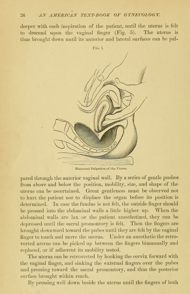 deeper with each inspiration of the patient, until the uterus is felt to descend upon the vaginal finger (Fig. 5). The uterus is thus brought down until its anterior and lateral surfaces can be pal- FlG Bimanual Palpation of the Uterus. pated through the anterior vaginal wall. By a series of gentle pushes from above and below the position, mobility, size, and shape of the uterus can be ascertained. Great gentleness must be observed not to hurt the patient nor to displace the organ before its position is determined. In case the fundus is not felt, the outside finger should be pressed into the abdominal walls a little higher up. AVhen the abdominal walls are lax or the patient anesthetized, they can be depressed until the sacral promontory is felt. Then the fingers are brought downward toward the pubes until they are felt by the vaginal finger to touch and move the uterus. Under an anesthetic the retro- verted uterus can be picked up between the fingers bimanually and replaced, or if adherent its mobility tested. The uterus can be retroverted by hooking the cervix forward with the vaginal finger, and sinking the external fingers over the pubes and pressing toward the sacral promontory, and thus the posterior surface brought within reach. By pressing well down beside the uterus until the fingers of both