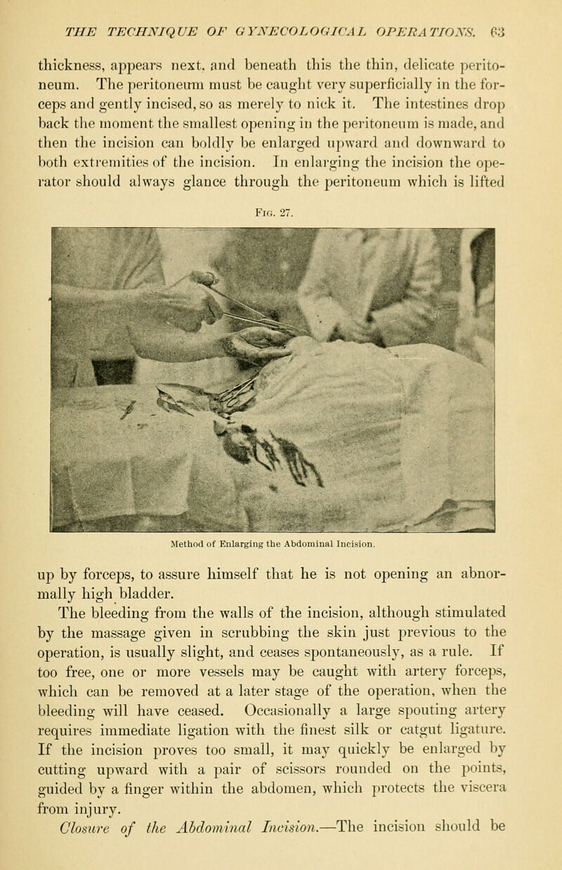 thickness, appears next, and beneath this the thin, delicate perito- neum. The peritoneum must be caught very superficially in the for- ceps and gently incised, so as merely to nick it. The intestines drop back the moment the smallest opening in the peritoneum is made, and then the incision can boldly be enlarged upward and downward to both extremities of the incision. In enlarging the incision the ope- rator should always glance through the peritoneum which is lifted Fig. 27. Method of Enlarging the Abdominal Incision. up by forceps, to assure himself that he is not opening an abnor- mally high bladder. The bleeding from the walls of the incision, although stimulated by the massage given in scrubbing the skin just previous to the operation, is usually slight, and ceases spontaneously, as a rule. If too free, one or more vessels may be caught with artery forceps, which can be removed at a later stage of the operation, when the bleeding will have ceased. Occasionally a large spouting artery requires immediate ligation with the finest silk or catgut ligature. If the incision proves too small, it may quickly be enlarged by cutting upward with a pair of scissors rounded on the points, guided by a finger within the abdomen, which protects the viscera from injury. Closure of the Abdominal Incision.—The incision should be