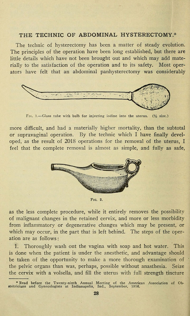 THE TECHNIC OF ABDOMINAL HYSTERECTOMY.* The technic of hysterectomy has been a matter of steady evolution. The principles of the operation have been long established, but there are little details which have not been brought out and which may add mate- rially to the satisfaction of the operation and to its safety. Most oper- ators have felt that an abdominal panhysterectomy was considerably I^iG. 1.—Glass tube with bulb for injecting iodine into the uterus. (% size.) more difficult, and had a materially higher mortality, than the subtotal or supravaginal operation. By the technic which I have finally devel- oped, as the result of 2018 operations for the removal of the uterus, I feel that the complete removal is almost as simple, and fully as safe, Fig. 2. as the less complete procedure, while it entirely removes the possibility of malignant changes in the retained cervix, and more or less morbidity from inflammatory or degenerative changes which may be present, or which may occur, in the part that is left behind. The steps of the oper- ation are as follows: 1. Thoroughly wash out the vagina with soap and hot water. This is done when the patient is under the anesthetic, and advantage should be taken of the opportunity to make a more thorough examination of the pelvic organs than was, perhaps, possible without anasthesia. Seize the cervix with a volsella, and fill the uterus with full strength tincture • Read before the Twenty-ninth Annual Meeting of the American Association of Ob- stetricians and Gynecologists at Indianapolis, Ind., September, 1916.