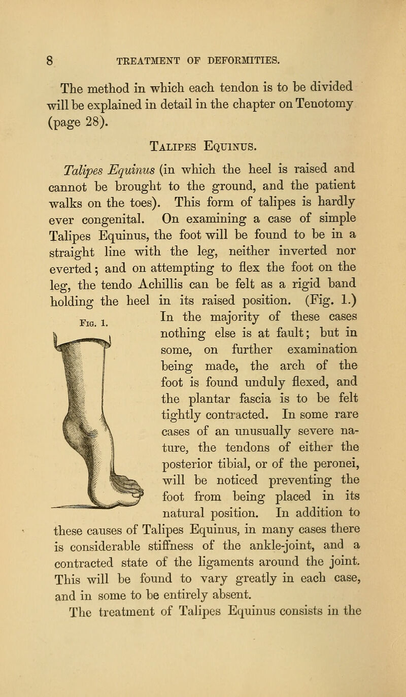 Fig. 1. The metliod in which each tendon is to be divided will be explained in detail in the chapter on Tenotomy (page 28). Talipes Equinus. Talipes Equinus (in which the heel is raised and cannot be brought to the ground, and the patient walks on the toes). This form of talipes is hardly ever congenital. On examining a case of simple Talipes Equinus, the foot will be found to be in a straight line with the leg, neither inverted nor everted; and on attempting to flex the foot on the leg, the tendo Achillis can be felt as a rigid band holding the heel in its raised position. (Fig. 1.) In the majority of these cases nothing else is at fault; but in some, on further examination being made, the arch of the foot is found unduly flexed, and the plantar fascia is to be felt tightly contracted. In some rare cases of an unusually severe na- ture, the tendons of either the posterior tibial, or of the peronei, will be noticed preventing the foot from being placed in its natural position. In addition to these causes of Talipes Equinus, in many cases there is considerable stiffness of the ankle-joint, and a contracted state of the ligaments around the joint. This will be found to vary greatly in each case, and in some to be entirely absent. The treatment of Talipes Equinus consists in the