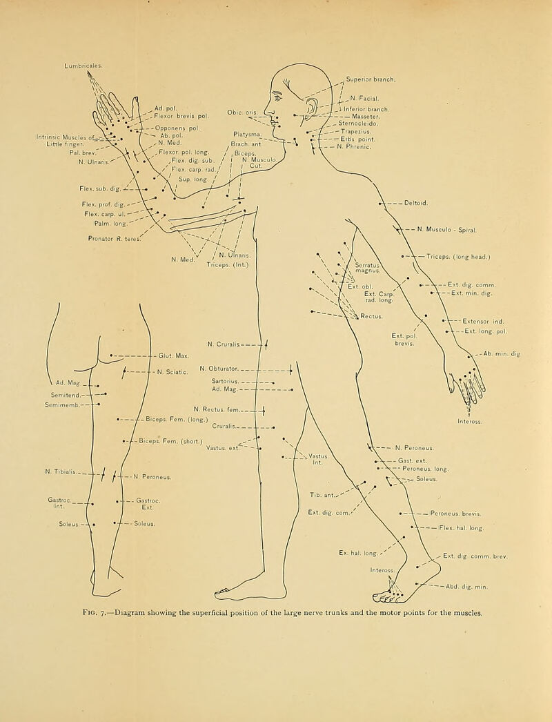 -Abd. dig. min Fig. 7.—Diagram showing the superficial posilion of the large nerve trunks and the motor points for the muscles.