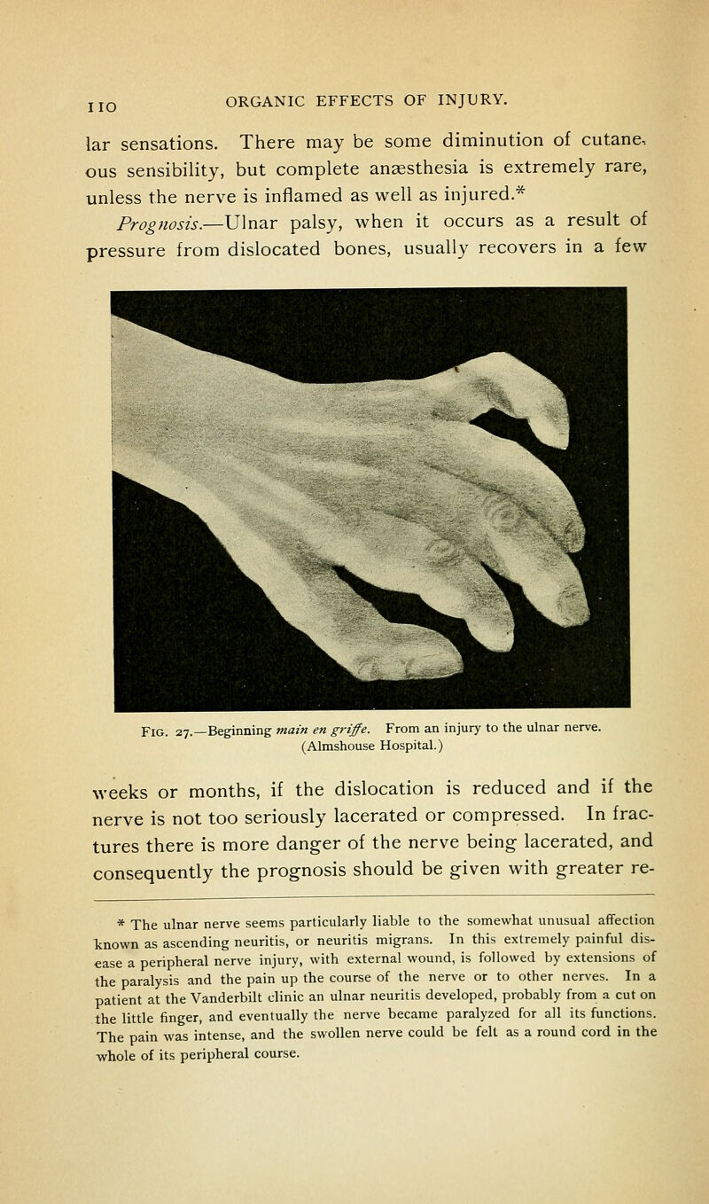 lar sensations. There may be some diminution of cutane, ous sensibility, but complete ansesthesia is extremely rare, unless the nerve is inflamed as well as injured.* Prognosis.—Ulnar palsy, when it occurs as a result of pressure from dislocated bones, usually recovers in a few Fig. 27.—Beginning main en griffe. From an injury to the ulnar nerve. (Almshouse Hospital.) weeks or months, if the dislocation is reduced and if the nerve is not too seriously lacerated or compressed. In frac- tures there is more danger of the nerve being lacerated, and consequently the prognosis should be given with greater re- * The ulnar nerve seems particularly liable to the somevk'hat unusual affection Icnown as ascending neuritis, or neuritis migrans. In this extremely painful dis- ease a peripheral nerve injury, with external wound, is followed by extensions of the paralysis and the pain up the course of the nerve or to other ner^'es. In a patient at the Vanderbilt clinic an ulnar neuritis developed, probably from a cut on the little finger, and eventually the nerve became paralyzed for all its functions. The pain was intense, and the swollen nerve could be felt as a round cord in the -whole of its peripheral course.