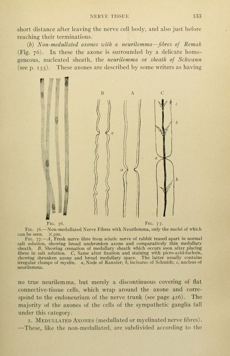 short distance after leaving the nerve cell body, and also just before reaching their terminations. {b) Non-meduUated axones with a neurilefnma—fibres of Remak (Fig. 76). In these the axone is surrounded by a delicate homo- geneous, nucleated sheath, the neurilemma or sheath of Schwann (see p. 135). These axones are described by some writers as having A I - /III 11 Fig. 76. Fic. 7 7. Fig. 76.—Non-meduUated Ncr\-e Fibres with Neurilemma, only the nuclei of which can be seen. X300. Fig. 77.—A, Fresh nerve fibre from sciatic nerve of rabbit teased apart in normal salt solution, showing broad unshrunken axone and comparatively thin medullary sheath. B, Showing crenation of medullary sheath which occurs soon after placing fibres in salt solution. C, Same after fixation and staining with picro-acid-fuchsin, showing shrunken axone and broad medullary space. The latter usually contains irregular clumps of myelin, a, Node of Ranvier; b, incisures of Schmidt; c, nucleus of neurilemma. no true neurilemma, but merely a discontinuous covering of flat connective-tissue cells, which wrap around the axone and corre- spond to the end(meurium of the nerve trunk (see page 426). The majority of the axones of the cells of the sympathetic ganglia fall under this category. 2. Meuullated Axones (mcduUatcd or myelinated nerve fibres). —The.se, like the non-medullated, are subdivided according to the