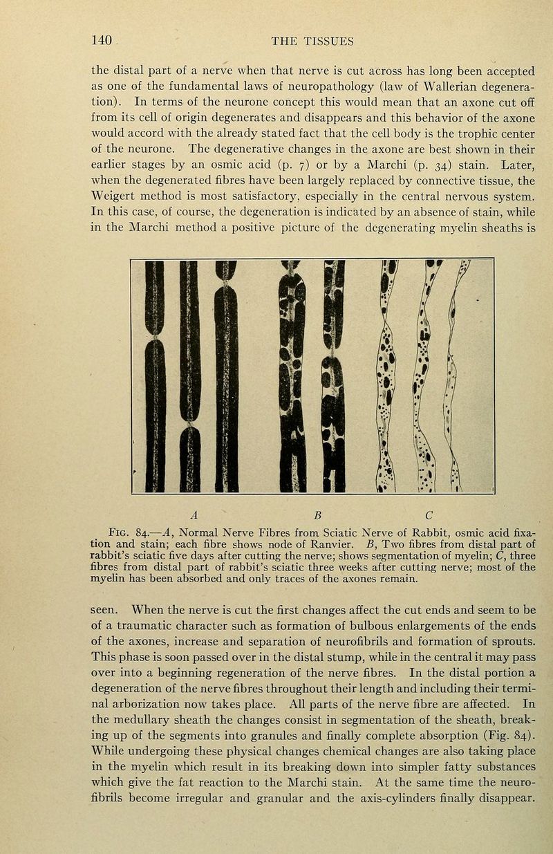 the distal part of a nerve when that nerve is cut across has long been accepted as one of the fundamental laws of neuropathology (law of Wallerian degenera- tion). In terms of the neurone concept this would mean that an axone cut off from its cell of origin degenerates and disappears and this behavior of the axone would accord with the already stated fact that the cell body is the trophic center of the neurone. The degenerative changes in the axone are best shown in their earlier stages by an osmic acid (p. 7) or by a Marchi (p. 34) stain. Later, when the degenerated fibres have been largely replaced by connective tissue, the Weigert method is most satisfactory, especially in the central nervous system. In this case, of course, the degeneration is indicated by an absence of stain, while in the Marchi method a positive picture of the degenerating myelin sheaths is B C Fig. 84.—A, Normal Nerve Fibres from Sciatic Nerve of Rabbit, osmic acid fixa- tion and stain; each fibre shows node of Ranvier. B, Two fibres from distal part of rabbit's sciatic five days after cutting the nerve; shows segmentation of myelin; C, three fibres from distal part of rabbit's sciatic three weeks after cutting nerve; most of the myelin has been absorbed and only traces of the axones remain. seen. When the nerve is cut the first changes affect the cut ends and seem to be of a traumatic character such as formation of bulbous enlargements of the ends of the axones, increase and separation of neurofibrils and formation of sprouts. This phase is soon passed over in the distal stump, while in the central it may pass over into a beginning regeneration of the nerve fibres. In the distal portion a degeneration of the nerve fibres throughout their length and including their termi- nal arborization now takes place. All parts of the nerve fibre are affected. In the medullary sheath the changes consist in segmentation of the sheath, break- ing up of the segments into granules and finally complete absorption (Fig. 84). While undergoing these physical changes chemical changes are also taking place in the myelin which result in its breaking down into simpler fatty substances which give the fat reaction to the Marchi stain. At the same time the neuro- fibrils become irregular and granular and the axis-cylinders finally disappear.
