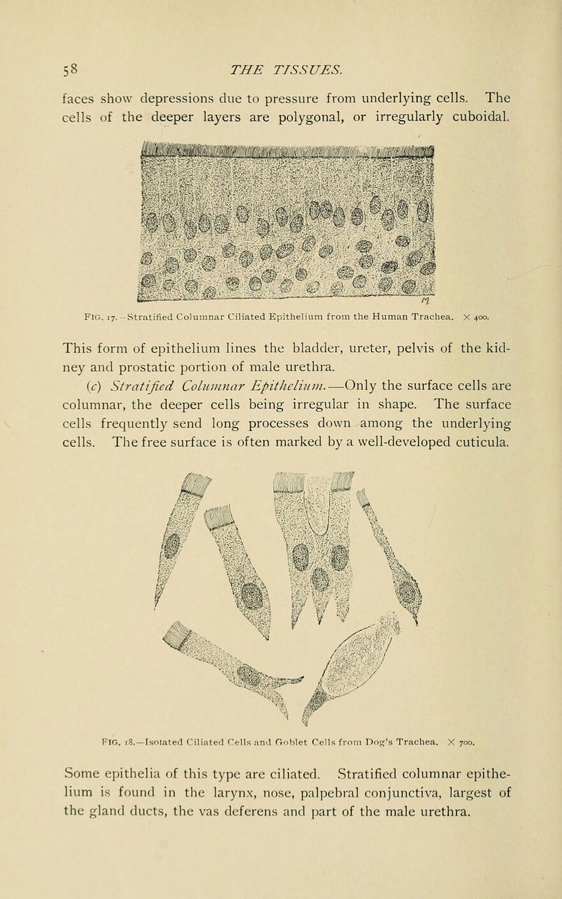 faces show depressions due to pressure from underlying cells. The cells of the deeper layers are polygonal, or irregularly cuboidal. '■■■'■■■■ ':■--' :'■':' ;>■;■'■ ' Si ' il^Hsl >J '• rJ* Fig. 17. -Stratified Columnar Ciliated Epithelium from the Human Trachea. X 400. This form of epithelium lines the bladder, ureter, pelvis of the kid- ney and prostatic portion of male urethra. U) Stratified Columnar Epithelium.-—Only the surface cells are columnar, the deeper cells being irregular in shape. The surface cells frequently send long processes down among the underlying cells. The free surface is often marked by a well-developed cuticula. § ^pga m ,'• $$$(:<■: - m ■■ l> ■>% l- H f V •■■■■ Fig. 18.—Isolated Ciliated Cells and Goblet Cells from Dog's Trachea. X 700. Some epithelia of this type are ciliated. Stratified columnar epithe- lium is found in the larynx, nose, palpebral conjunctiva, largest of the gland ducts, the vas deferens and part of the male urethra.