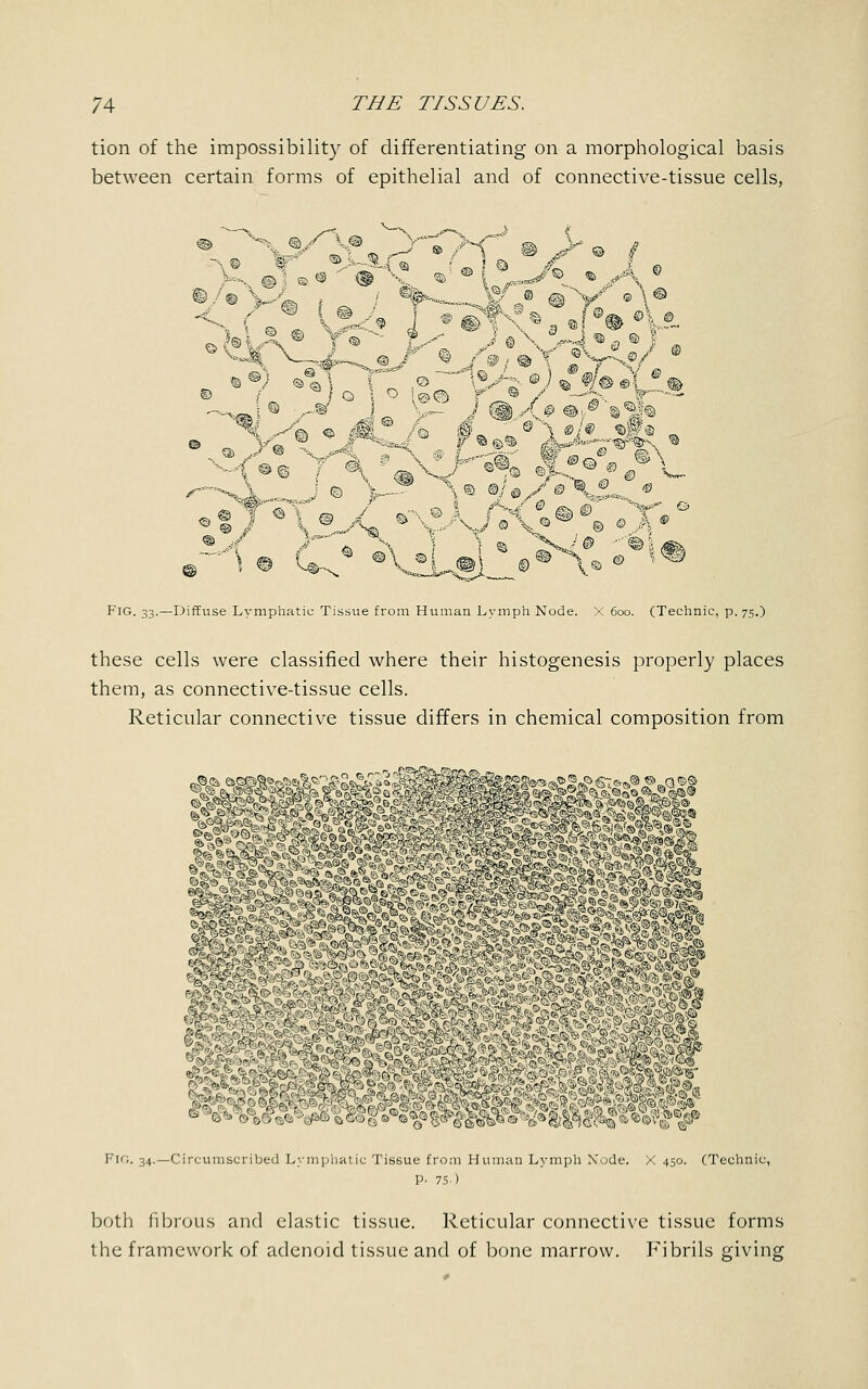 tion of the impossibility of differentiating on a morphological basis between certain forms of epithelial and of connective-tissue cells, <^ >^m i ® ,5(8) * -*at -,^-;-. m 'v' ® # •iT\ % t © i© Fig. 33.—Diffuse Lymphatic Tissue from Human Lymph Node. X 600. (Technic, p. 75.) these cells were classified where their histogenesis properly places them, as connective-tissue cells. Reticular connective tissue differs in chemical composition from FIG. 34.—Circumscribed Lymphatic Tissue from Human Lymph Node. X 450. (Technic, P. 75) both fibrous and elastic tissue. Reticular connective tissue forms the framework of adenoid tissue and of bone marrow. Fibrils giving