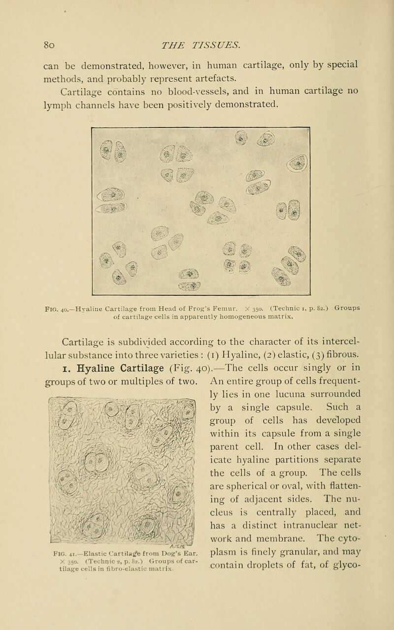 can be demonstrated, however, in human cartilage, only by special methods, and probably represent artefacts. Cartilage contains no blood-vessels, and in human cartilage no lymph channels have been positively demonstrated. 4?3 .-•■ m& ■■■■ * mi <m m m (SHIP Fig. 40.—Hyaline Cartilage from Head of Frog's Femur. X 350. (Technic 1, p. S2.) Groups of cartilage cells in apparently homogeneous matrix. Cartilage is subdivided according to the character of its intercel- lular substance into three varieties : (1) Hyaline, (2) elastic, (3) fibrous. 1. Hyaline Cartilage (Fig. 40).—The cells occur singly or in groups of two or multiples of two. {'- 1 i FIG. 41.—Elastic Cartilage from Dog's Ear. [o. c'l'echnic 2, p. 82.) Groups of car- tilage cells in fibro-elastic matrix. An entire group of cells frequent- ly lies in one lucuna surrounded by a single capsule. Such a group of cells has developed within its capsule from a single parent cell. In other cases del- icate hyaline partitions separate the cells of a group. The cells are spherical or oval, with flatten- ing of adjacent sides. The nu- cleus is centrally placed, and has a distinct intranuclear net- work and membrane. The cyto- plasm is finely granular, and may contain droplets of fat, of glyco-