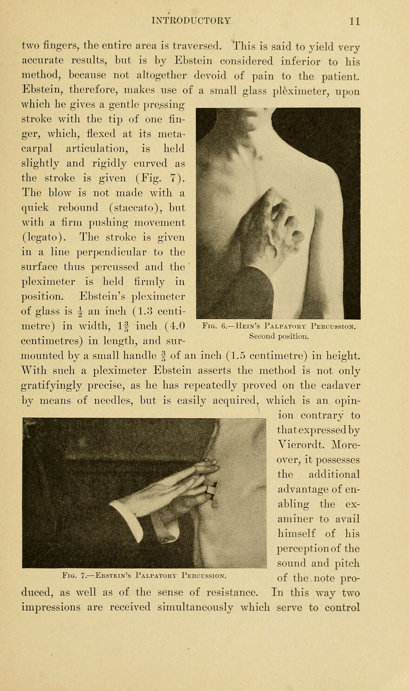 two fingers, the entire area is traversed. This is said to yield very accurate results, but is by Ebstein considered inferior to his method, because not altogether devoid of pain to the patient. Ebstein, therefore, makes use of a small glass pleximeter, upon which he gives a gentle prejssing stroke with the tip of one fin- ger, which, flexed at its meta- carpal articulation, is held slightly and rigidly curved as the stroke is given (Fig. 7). The blow is not made with a quick rebound (staccato), but with a firm pushing movement (legato). The stroke is given in a line perpendicular to the surface thus percussed and the pleximeter is held firmly in position. Ebstein's pleximeter of glass is ^ an inch (1.3 centi- metre) in width. If inch (4.0 centimetres) in length, and sur- mounted by a small handle f of an inch (1.5 centimetre) in height. With such a pleximeter Ebstein asserts the method is not only gratifyingly precise, as he has repeatedly proved on the cadaver by means of needles, but is easily acquired, which is an opin- ion contrary to that expressed by Vierordt. More- over, it possesses the additional advantage of en- abling the ex- aminer to avail himself of his perception of the sound and pitch of the note pro- duced, as well as of the sense of resistance. In this way two impressions are received simultaneously which serve to control Fig. 6.- -Hein's Palpatoby Percussion. Second position. Ebstein's Palpatory Percussion.