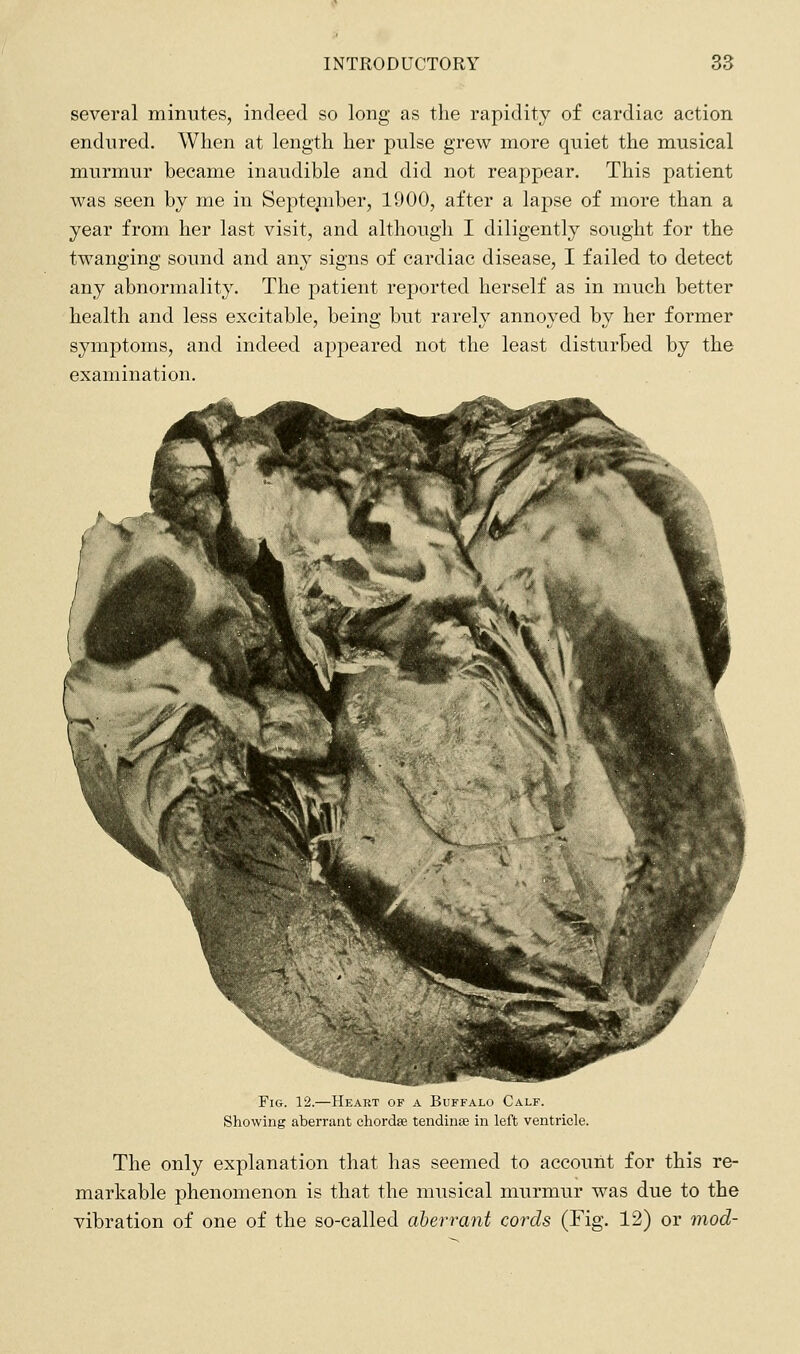 several minutes, indeed so long as the rapidity of cardiac action endured. When at length her pulse grew more quiet the musical murmur became inaudible and did not reappear. This patient was seen by me in Septe^nber, 1900, after a lapse of more than a year from her last visit, and although I diligently sought for the twanging sound and any signs of cardiac disease, I failed to detect any abnormality. The patient reported herself as in much better health and less excitable, being but rarely annoyed by her former symptoms, and indeed appeared not the least disturbed by the examination. Fig. 12.—Heart of a Buffalo Calf. Showing aberrant chordfe tendinee in left ventricle. The only explanation that has seemed to account for this re- markable phenomenon is that the musical murmur was due to the vibration of one of the so-called aberrant cords (Fig. 12) or mod-