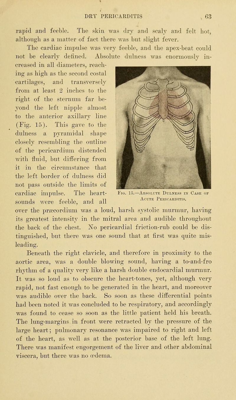 rapid and feeble. The skin was dry and scaly and felt hot, although as a matter of fact there was but slight fever. The cardiac impulse was very feeble, and the apex-beat could not be clearly defined. Absolute dulness was enormously in- creased in all diameters, reach- ing as high as the second costal cartilages, and transversely from at least 2 inches to the right of the sternum far be- yond the left nipple almost to the anterior axillary line (Fig. 15). This gave to the dulness a pyramidal shape closely resembling the outline of the pericardium distended wutli fluid, but differing from it in the circumstance that the left border of dulness did not pass outside the limits of cardiac impulse. The heart- sounds were feeble, and all over the prgecordium was a loud, harsh systolic murmur, having its greatest intensity in the mitral area and audible throughout the back of the chest. jSTo pericardial friction-rub could be dis- tinguished, but there w^as one sound that at first was quite mis- leading. Beneath the right clavicle, and therefore in proximity to the aortic area, was a double blowing sound, having a to-and-fro rhythm of a quality very like a harsh double endocardial murmur. It was so loud as to obscure the heart-tones, yet, although very rapid, not fast enough to be generated in the heart, and moreover was audible over the back. So soon as these differential points had been noted it was concluded to be respiratory, and accordingly w^as found to cease so soon as the little patient held his breath. The lung-margins in front were retracted by the pressure of the large heart; pulmonary resonance was impaired to right and left of the heart, as well as at the posterior base of the left lung. There was manifest engorgement of the liver and other abdominal viscera, but there was no oodema. Fig. 15.- -Absolute Dulness in Case of Acute Pericarditis.