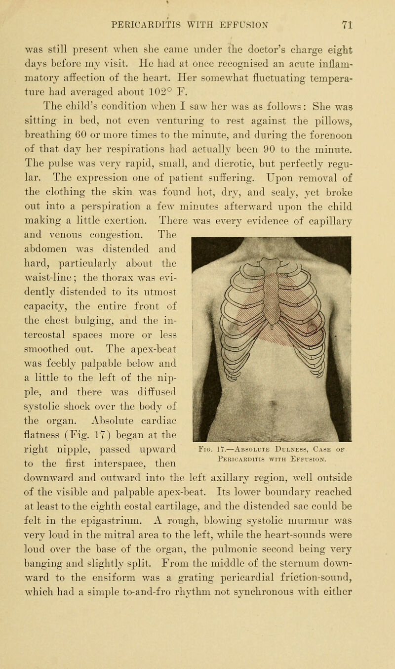 was still present when slie came nnder the doctor's charge eight days before my visit. lie had at once recognised an acute inflam- matory affection of the heart. Her somewhat fluctuating tempera- ture had averaged about 102° F. The child's condition when I saw her was as follows: She was sitting in bed, not even venturing to rest against the pillows, breathing 60 or more times to the minute, and during the forenoon of that day her respirations had actually been 90 to the minute. The pulse was very rapid, small, and dicrotic, but perfectly regu- lar. The expression one of patient sufi^ering. Upon removal of the clothing the skin was found hot, dry, and scaly, yet broke out into a perspiration a few minutes afterward upon the child There was every evidence of capillary The making a little exertion and venous congestion. abdomen M'as distended and hard, particularly about the waist-line; the thorax was evi- dently distended to its utmost capacity, the entire front of the chest bulging, and the in- tercostal spaces more or less smoothed out. The apex-beat was feebly palpable below and a little to the left of the nip- ple, and there was diffused systolic shock over the body of the organ. Absolute cardiac flatness (Fig. 17) began at the right nipple, passed upward to the first interspace, then downward and outward into the left axillary region, well outside of the visible and palpable apex-beat. Its lower boundary reached at least to the eighth costal cartilage, and the distended sac could be felt in the epigastrium. A rough, blowing systolic murmur was very loud in the mitral area to the left, while the heart-sounds were loud over the base of the organ, the pulmonic second being very banging and slightly split. From the middle of the sternum down- ward to the ensiform was a grating pericardial friction-sound, which had a simple to-and-fro rhythm not synchronous with either 17.—Absiiute Dii.m;--. i ase of Pericarditis with Effusion.