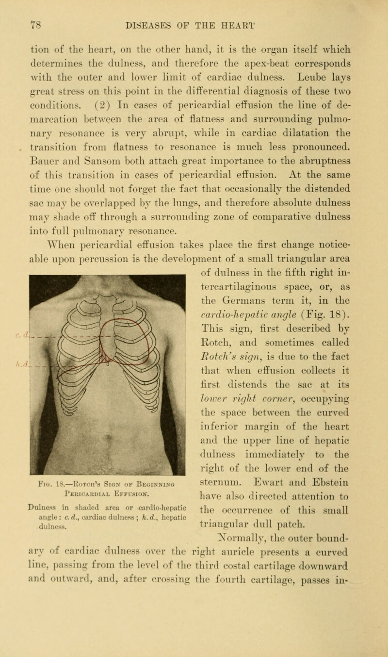 tion of the heart, on the other hand, it is the organ itself which determines the dulness, and therefore the apex-beat corresponds with the onter and lower limit of cardiac dulness. Leube lays great stress on this point in the differential diagnosis of these two conditions. (2) In cases of pericardial effusion the line of de- marcation between the area of flatness and surrounding pulmo- nary resonance is very abrupt, while in cardiac dilatation the transition from flatness to resonance is much less pronounced. Bauer and Sansom both attach great importance to the abruptness of this transition in cases of pericardial effusion. At the same time one should not forget the fact that occasionally the distended sac may be overlapped by the lungs, and therefore absolute dulness may shade off through a surrounding zone of comparative dulness into full pulmonary resonance. When pericardial effusion takes place the first change notice- able upon percussion is the development of a small triangular area of dulness in the fifth right in- tercartilaginous space, or, as the Germans term it, in the cardio-hepatic angle (Fig. 18). This sign, first described by Rotch, and sometimes called Botch's sign, is due to the fact that when eft'usion collects it first distends the sac at its lower right corner, occupying the space between the curved inferior margin of the heart and the upper line of hepatic dulness immediately to the right of the lower end of the sternum. Ewart and Ebstein have also directed attention to the occurrence of this small triangular dull patch. Xormally, the outer bound- ary of cardiac dulness over the right auricle presents a curved line, passing from the level of the third costal cartilage downward and outward, and, after crossing the fourth cartilage, passes in- ili.. i^. i;<r|l irM SjliN (IK lJK(il.NNlNU Pekicaudial Effusion. Dulnesa in sliaded area or cardio-hepatic an^rle: c.d., cardiac dulness ; h.d., hepatic dulness.