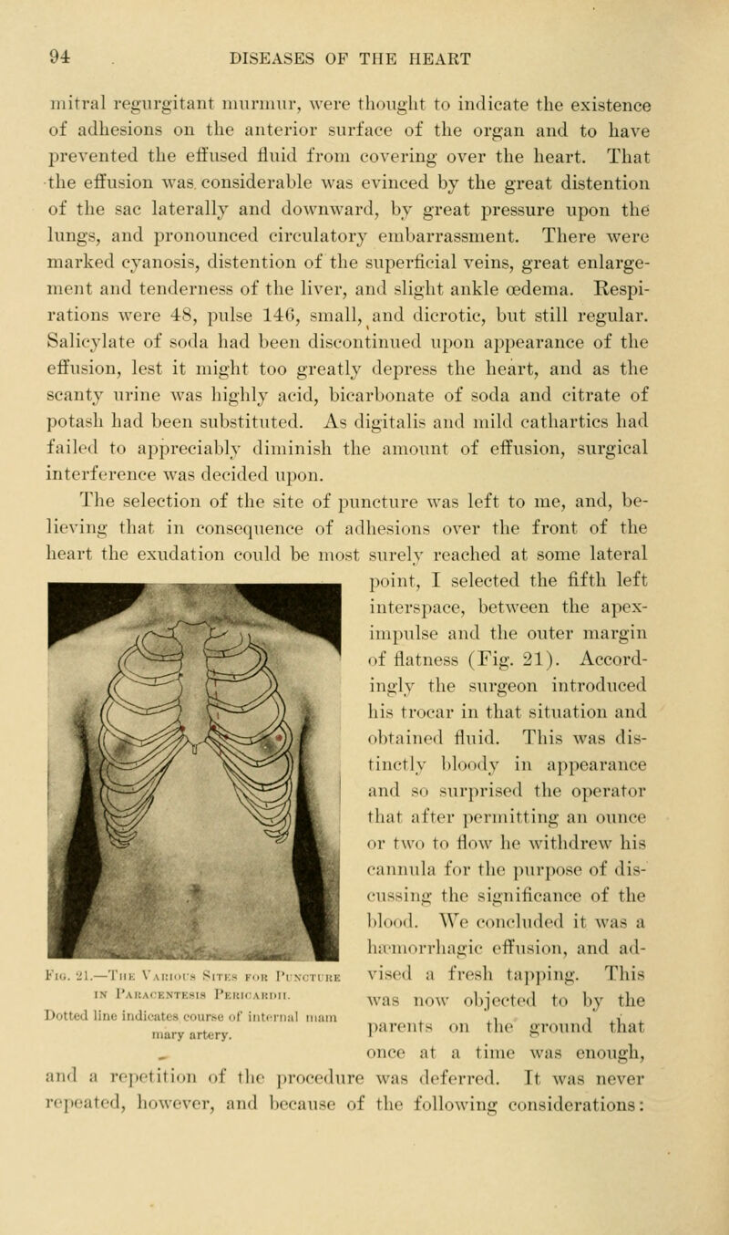 mitral regurgitant inuriiuir, were thought to indicate the existence of adhesions on the anterior surface of the organ and to have prevented the eifused fluid from covering over the heart. That the effusion was considerable was evinced by the great distention of the sac laterally and downward, by great pressure upon the lungs, and pronounced circulatory embarrassment. There were marked cyanosis, distention of the superficial veins, great enlarge- ment and tenderness of the liver, and slight ankle oedema. Respi- rations were 48, pulse 146, small, and dicrotic, but still regular. Salicylate of soda had been discontinued upon appearance of the effusion, lest it might too greatly depress the heart, and as the scanty urine was highly acid, bicarbonate of soda and citrate of potash had been substituted. As digitalis and mild cathartics had failed to appreciably diminish the amount of effusion, surgical interference was decided upon. The selection of the site of puncture was left to me, and, be- lieving that in consequence of adhesions over the front of the heart the exudation could be most surely reached at some lateral point, I selected the fifth left interspace, between the apex- impulse and the outer margin of flatness (Fig. 21). Accord- ingly the surgeon introduced his trocar in that situation and obtained fluid. This was dis- tinctly bloody in appearance and so surprised the operator that after ixn-mitting an ounce or two to flow he withdrew his cannula for the purpose of dis- cussing the significance of the blood. We concluded it was a hu'morrhagic effusion, and ad- vised a fresh tapi)iiig. This was now objected to by the ])are)its on the ground that once at a time was enough, and a repetition of the |)rocedure was deferred. It was never repeated, however, and because of the following considerations: 'Jl.—'I'lIK VAIilors SiTi;- I'.i: I'l \. II i;l' IV Paisacentesis Pekicardii. Dotted line indicates course of interniil main mary artery.