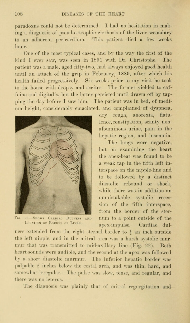 paradoxus could not be detennined. I had no hesitation in mak- ing a diagnosis of pseudo-atrophic cirrhosis of the liver secondary to an adherent pericardium. This patient died a few weeks later. One of the most typical cases, and by the way the first of the kind I ever saw, was seen in 1801 with Dr. Christophe. The patient was a male, aged fifty-two, had always enjoyed good health until an attack of the grip in February, 1880, after Avhich his health failed progressively. Six weeks prior to my visit he took to the house with dropsy and ascites. The former yielded to caf- feine and digitalis, but the latter persisted until drawn off by tap- ping the day before I saw him. The patient was in bed, of medi- um height, considerably emaciated, and complained of dyspncea, dry cough, anorexia, flatu- lence, constipation, scanty non- albuminous urine, pain in the hepatic region, and insomnia. The lungs were negative, but on examining the heart the apex-beat was found to be a weak tap in the fifth left in- terspace on the nipple-line and to be followed by a distinct diastolic rebound or shock, while there was in addition an unmistakable systolic reces- sion of the fifth interspace, from the border of the ster- num to a point outside of the apex-impulse. Cardiac dul- ness extended from the right sternal border to ^ an inch outside the left nipple, and in the mitral area was a harsh systolic mur- mur that was transmitted to mid-axillary line (Fig. '22). Both heart-sounds were audible, and the socoiid at the apex was followed by a short diastolic murmur. The inferior hepatic border was palpable 2 inches below the costal arch, and was thin, hard, and somewhat irregular. The ])ulse was slow, tense, and regular, and there was no icterus. The diagnosis was jdainly that of mitral regurgitation and Location of Border of Liver.