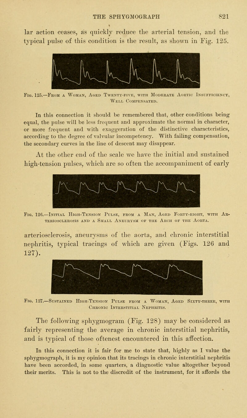 lar action ceases, as quicklj- reduce the arterial tension, and the typical pulse of this condition is the result, as shown in Fig. 125. Fig. 125.—Fkom a Woman, Aged Twenty-five, with Mouekate Aoktic Insufficiency, Well Compensated. In this connection it should be remembered that, other conditions being equal, the pulse will be less frequent and approximate the normal in character, or more frequent and with exaggeration of the distinctive characteristics, according to the degree of valvular incompetency. With failing compensation, the secondary curves in the line of descent may disappear. At the other end of the scale we have the initial and sustained high-tension pulses, which are so often the accompaniment of early Fig. 126.—Initial High-Tension Pulse, from a Man, Aged Forty-eight, with Ar- teriosclerosis and a Small Aneurysm of the Arch of the Aorta. arteriosclerosis, aneurysms of the aorta, and chronic interstitial nephritis, typical tracings of which are given (Figs. 126 and 12Y). Fig. 127.—Sustained High-Tension Pulse from a Woman, Aged Sixty-three, with Chronic Interstitial Nephritis. The following sphygmogram (Fig. 128) may be considered as fairly representing the average in chronic interstitial nephritis, and is typical of those oftenest encountered in this affection. In this connection it is fair for me to state that, highly as I value the sphygmograph, it is my opinion that its tracings in chronic interstitial nephritis have been accorded, in some quarters, a diagnostic value altogether beyond their merits. This is not to the discredit of the instrument, for it afiords the