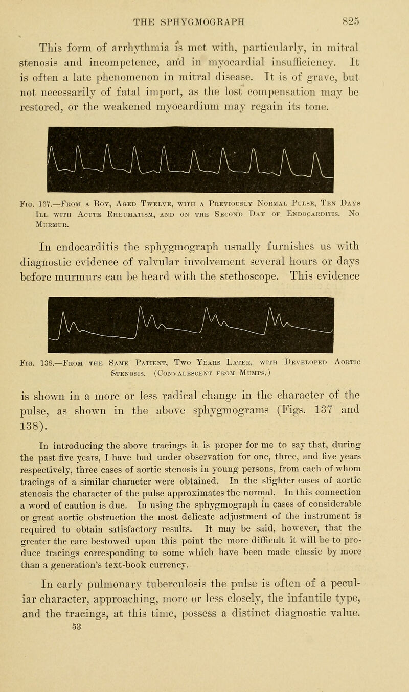 This form of arrhythmia is met with, particularly, in mitral stenosis and incompetence, arid in myocardial insufficiency. It is often a late plienonienon in mitral disease. It is of grave, but not necessarily of fatal import, as the lost compensation may be restored, or the weakened myocardium may regain its tone. Fig. 137.—From a Boy, Aged Twelve, with a Pkeviously Normal Pulse, Ten Days III with Acute Kheumatism, and on the Second Day of Endocakditis. No Murmur. In endocarditis the sphygmograph usually furnishes us Avith diagnostic evidence of valvular involvement several hours or days before murmurs can be heard with the stethoscope. This evidence Fig. 138.—From the Same Patient, Two Years Later, with Developed Aortic Stenosis. (Convalescent from Mumps.) is shown in a more or less radical change in the character of the pulse, as shown in the above sphygmograms (Figs. 137 and 138). In introducing the above tracings it is proper for me to say that, during the past five years, I have had under observation for one, three, and five years respectively, three cases of aortic stenosis in young persons, from each of whom tracings of a similar character were obtained. In the slighter cases of aortic stenosis the character of the pulse approximates the normal. In this connection a word of caution is due. In using the sphygmograph in cases of considerable or great aortic obstruction the most delicate adjustment of the instrument is required to obtain satisfactory results. It may be said, however, that the greater the care bestowed upon this point the more difficult it will be to pro- duce tracings corresponding to some which have been made classic by more than a generation's text-book currency. In early pulmonary tuberculosis the pulse is often of a pecul- iar character, approaching, more or less closely, the infantile type, and the tracings, at this time, possess a distinct diagnostic value. 53