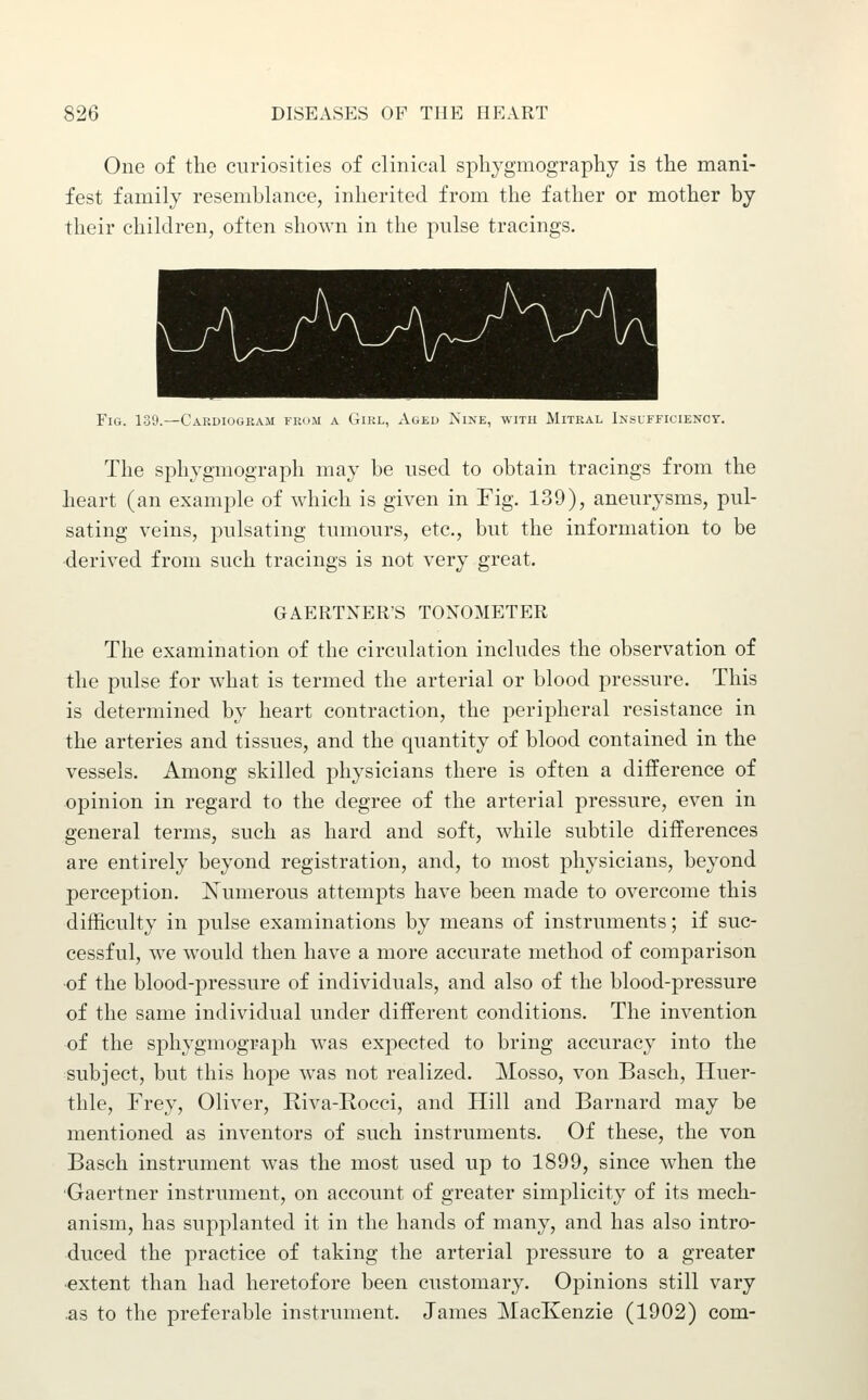 One of the curiosities of clinical spliygmography is the mani- fest family resemblance, inherited from the father or mother bj their children, often shown in the pulse tracings. Fig. 139.—Cardiogram frum a Girl, xVueu Nine, with Mitral Insufficienct. The sphygmograph may be used to obtain tracings from the heart (an example of which is given in Fig. 139), aneurysms, pul- sating veins, pulsating tumours, etc., but the information to be derived from such tracings is not very great. GAERTNER'S TONOMETER The examination of the circulation includes the observation of the pulse for what is termed the arterial or blood pressure. This is determined by heart contraction, the peripheral resistance in the arteries and tissues, and the quantity of blood contained in the vessels. Among skilled physicians there is often a difference of opinion in regard to the degree of the arterial pressure, even in general terms, such as hard and soft, while subtile differences are entirely beyond registration, and, to most physicians, beyond perception. Numerous attempts have been made to overcome this difficulty in pulse examinations by means of instruments; if suc- cessful, we would then have a more accurate method of comparison of the blood-pressure of individuals, and also of the blood-pressure of the same individual under different conditions. The invention of the sphygmograph was expected to bring accuracy into the subject, but this hope was not realized. Mosso, von Basch, Iluer- thle, Frey, Oliver, Riva-Rocci, and Hill and Barnard may be mentioned as inventors of such instruments. Of these, the von Basch instrument w^as the most used up to 1899, since when the Gaertner instrument, on account of greater simplicity of its mech- anism, has supplanted it in the hands of many, and has also intro- duced the practice of taking the arterial pressure to a greater •extent than had heretofore been customary. Opinions still vary .as to the preferable instrument. James MacKenzie (1902) com-