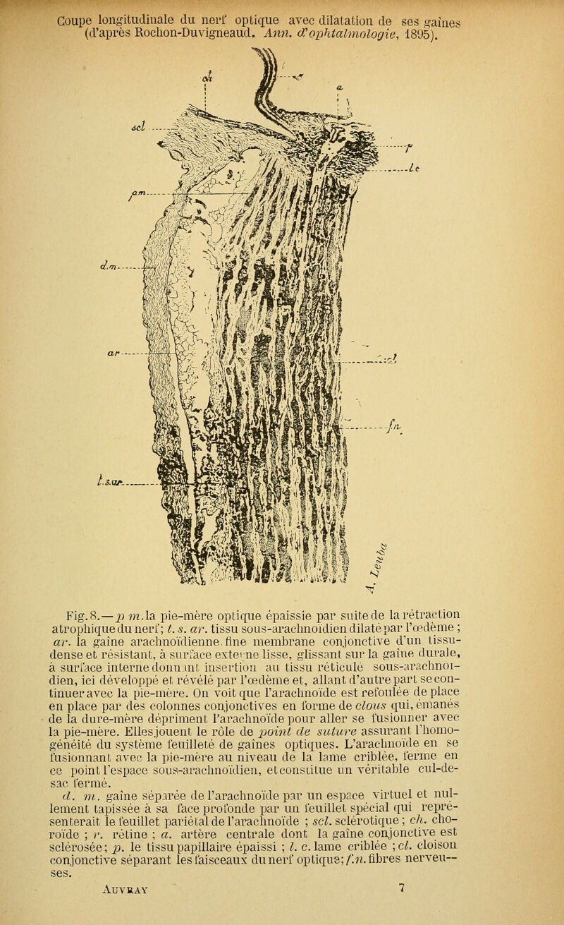 Coupe longitudinale du nerl' optique avec dilatation de ses gaines (d'après Rochon-Duvigneaud. Ann. cJ'ophtalmologie, 1895). a. m Fig.8.—p ;n.la pie-mère optique épaissie par suitede la rétraction atrophiquedu nerf; t. s. ar. tissu sous-araclinoïdien dilaté par l'œdème ; ar. la gaine arachnoïdienne.fine membrane conjonctive d'un tissu- dense et résistant, à surface externe lisse, glissant sur la gaine durale, à surface interne donnant insertion au tissu réticulé sous-arachnoi- dien, ici développé et révélé par l'œdème et, allant d'autre part se con- tinuer avec la pie-mère. On voit que l'arachnoïde est refoulée déplace en place par des colonnes conjonctives en forme de clous qui, émanés de la dure-mère dépriment l'arachnoïde pour aller se fusionner avec la pie-mère. Elles jouent le rôle de point de suture assurant l'homo- généité du système feuilleté de gaines optiques. L'arachnoïde en se fusionnant avec la pie-mère au niveau de la lame criblée, ferme en ce point l'espace sous-araehnoïdien, et constitue un véritable cul-de- sac fermé. d. m. gaine séparée de l'arachnoïde par un espace virtuel et nul- lement tapissée à sa face profonde par un feuillet spécial qui repré- senterait le feuillet pariétal de l'arachnoïde ; sc^. sclérotique ; ch. cho- roïde ; y. rétine ; a. artère centrale dont la gaine conjonctive est sclérosée; p. le tissupapUlaire épaissi ; l. clame criblée \cl. cloison conjonctive séparant les faisceaux du nerf optiqus;/.«. fibres nerveu- ses. AUVRAY ï