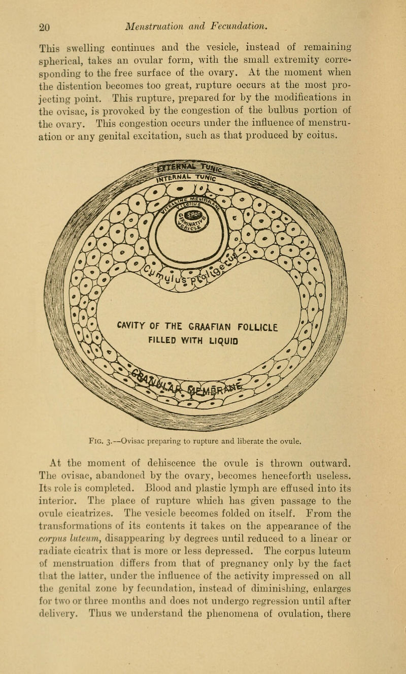 This swelling continues and the vesicle, instead of remaining spherical, takes an ovular form, with the small extremity corre- sponding to the free surface of the ovary. At the moment when the distention hecomes too great, rupture occurs at the most pro- jecting point. This rupture, prepared for by the modifications in the ovisac, is provoked by the congestion of the bulbus portion of the ovary. This congestion occurs under the influence of menstru- ation or any genital excitation, such as that produced by coitus. Fig. 3.—Ovisac preparing to rupture and liberate the ovule. At the moment of dehiscence the ovule is thrown outward. The ovisac, abandoned by the ovary, becomes henceforth useless. Its role is completed. Blood and plastic lymph are effused into its interior. The place of rupture which has given passage to the ovule cicatrizes. The vesicle becomes folded on itself. From the transformations of its contents it takes on the appearance of the corpus liitcinn, disappearing by degrees until reduced to a linear or radiate cicatrix that is more or less depressed. The corpus luteum of menstruation differs from that of pregnancy only by the fact that the iatter, under the influence of the activity impressed on all the genital zone by fecundation, instead of diminishing, enlarges for two or three months and does not undergo regression until after delivery. Thus we understand the phenomena of ovulation, there